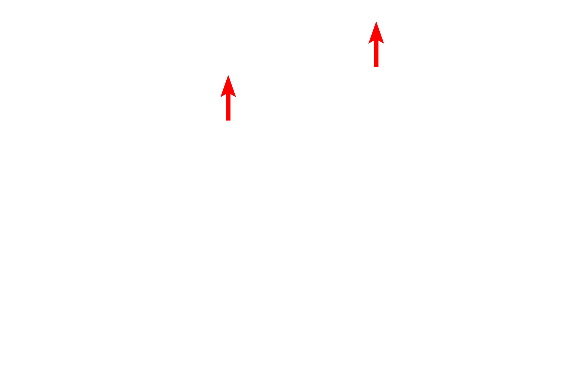 Capillaries <p>Two cells in prophase are present among the interphase cells in this image from the basal layer of the esophageal epithelium.  Chromosomes are condensed in these cells and their nucleoli and nuclear envelopes are absent. 1000x</p>
