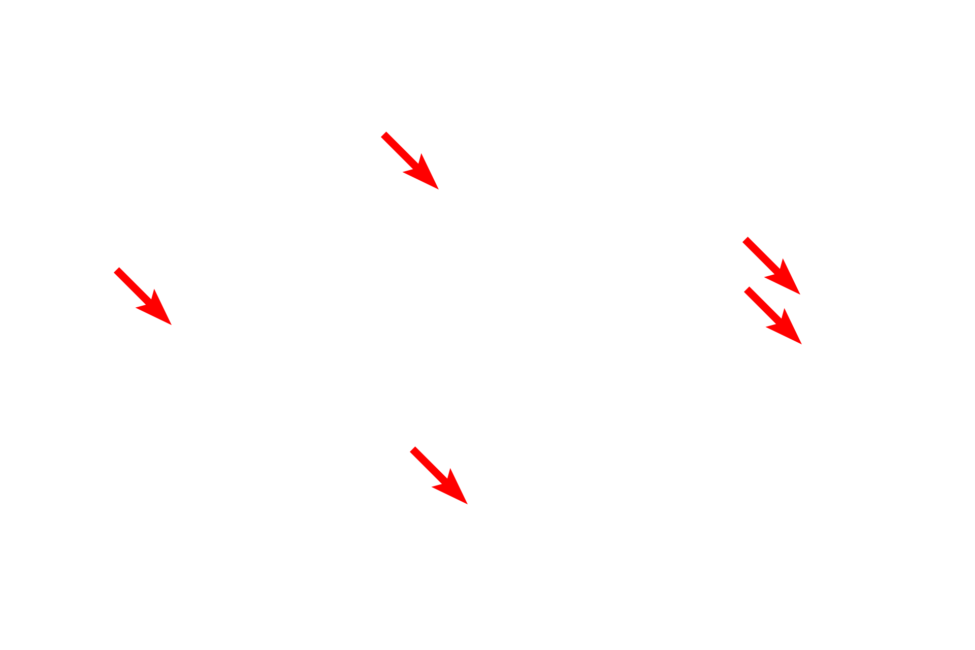 Sister chromatids <p>During metaphase, sister chromatids align forming the metaphase plate.  The first two panels show events early in this process as the chromatids migrate to the central region of the cell.  The third panel shows a fully formed metaphase plate with its mitotic spindle composed of microtubules.  Both centrosomes are also visible at the points where the microtubules converge. Whitefish blastula 1500x</p>
