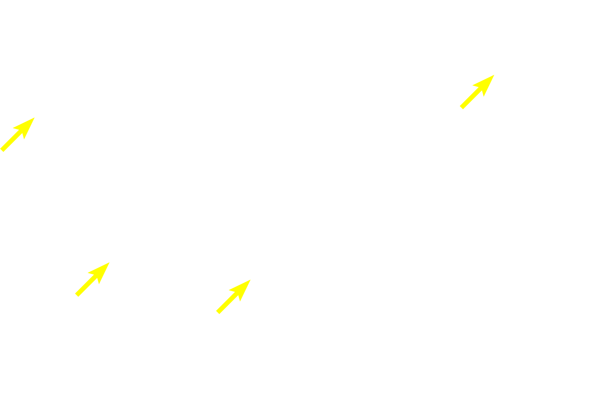 Interphase cells <p>These three panels show cells in metaphase from the lining epithelium of the esophagus.  Paired sister chromatids are tightly aligned in the center of the cell forming the metaphase plate.  Though not visible in this image, spindle apparatuses composed of microtubules are present, as are two centrosomes at opposite ends of the spindle. Esophageal epithelium 1000x</p>
