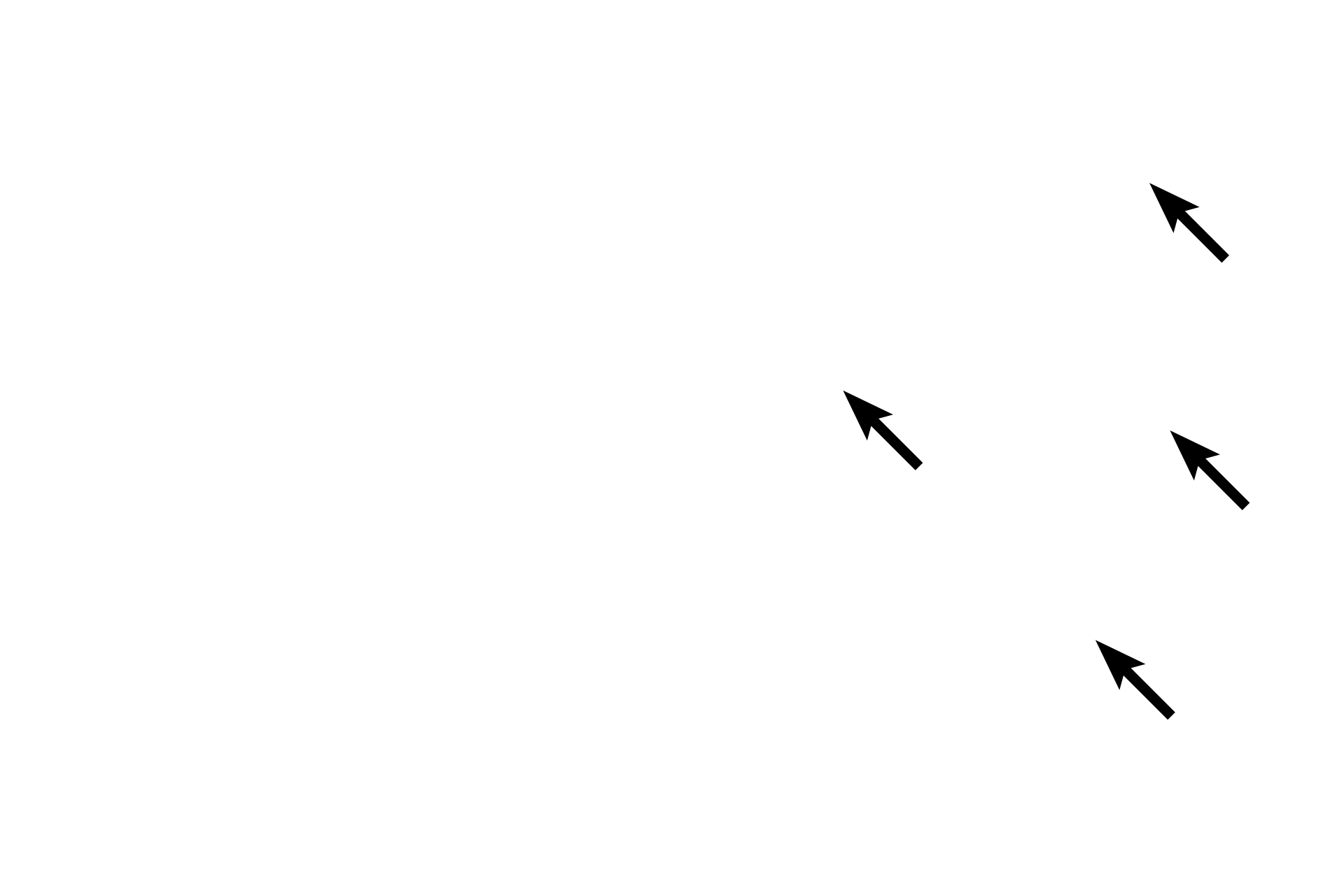 Intermediate filaments and microtubules <p>The cytoskeleton consists of fibrous structures providing support, movement and intracellular transport.  Components include microfilaments (4-6 nm), intermediate filaments (8-10 nm) and microtubules (20-25 nm).  Microfilaments and microtubules are similar in all cells, while intermediate filaments are heterogeneous and cell-type specific.  800x, 1000x</p>
