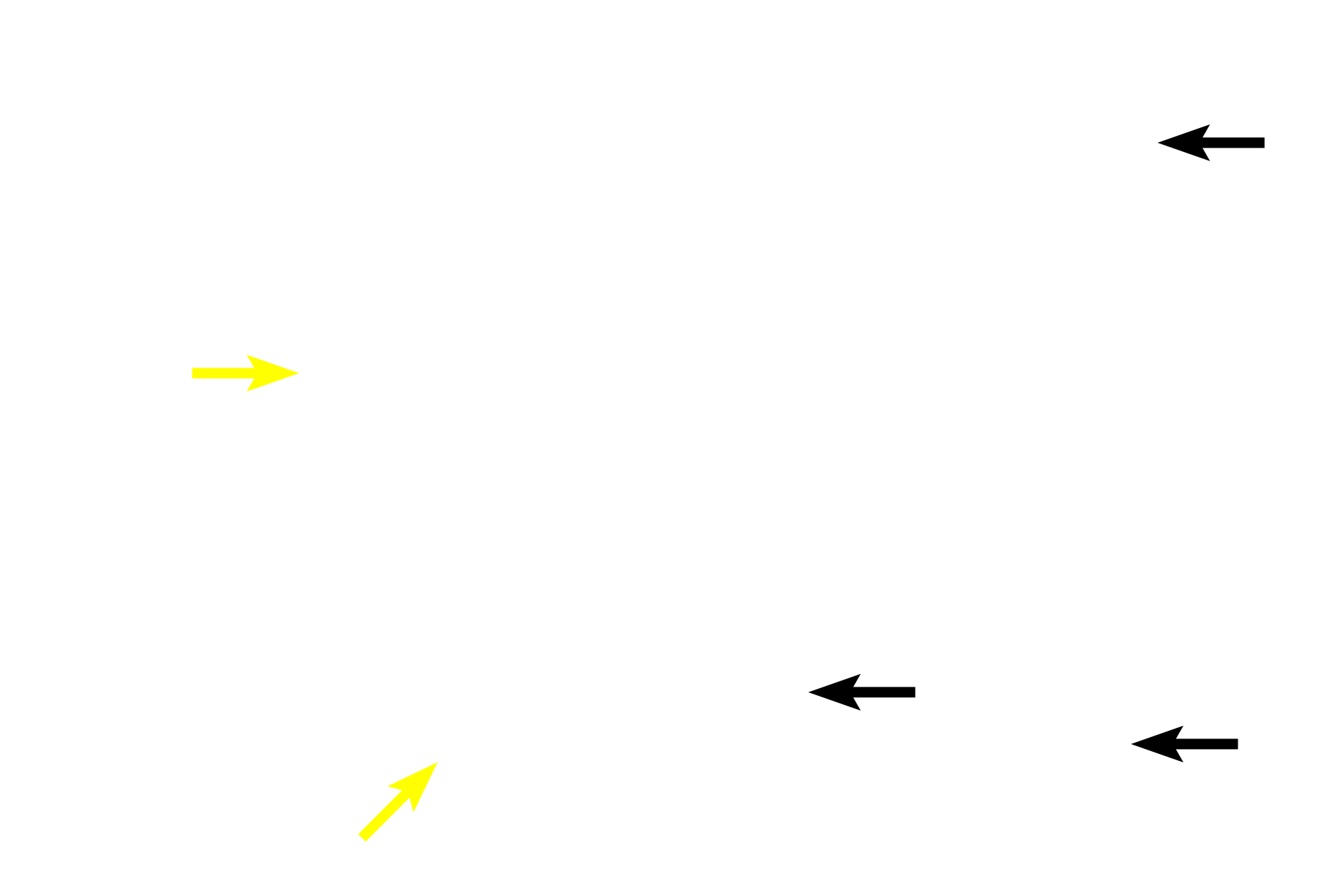 Cell processes <p>The cytoskeleton consists of fibrous structures providing support, movement and intracellular transport.  Components include microfilaments (4-6 nm), intermediate filaments (8-10 nm) and microtubules (20-25 nm).  Microfilaments and microtubules are similar in all cells, while intermediate filaments are heterogeneous and cell-type specific.  800x, 1000x</p>
