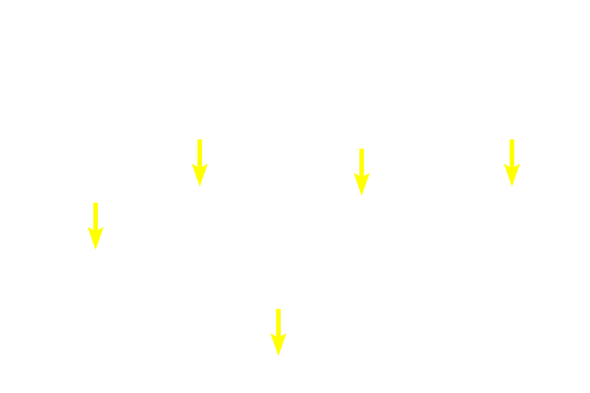 Microfilament bundles <p>Three fibroblasts in culture were stained with fluorescently-labeled phalloidin, which specifically binds to actin, the protein that makes up microfilaments.  In these cells, microfilaments form stress fibers that form a complex network throughout the cytoplasm to provide support for the cell and its processes.  The filaments outline the position of the nucleus.  Microfilaments are also concentrated beneath the plasma membrane.  800x</p>

