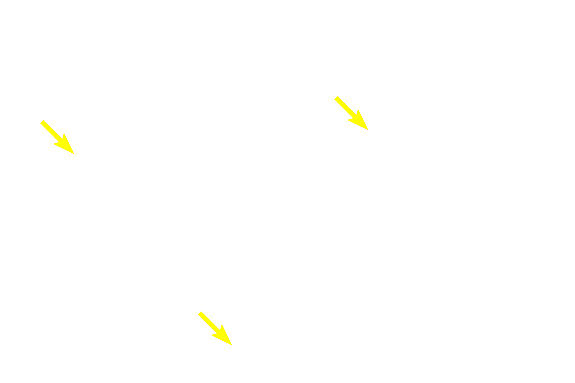 Cell processes <p>Three fibroblasts in culture were stained with fluorescently-labeled phalloidin, which specifically binds to actin, the protein that makes up microfilaments.  In these cells, microfilaments form stress fibers that form a complex network throughout the cytoplasm to provide support for the cell and its processes.  The filaments outline the position of the nucleus.  Microfilaments are also concentrated beneath the plasma membrane.  800x</p>

