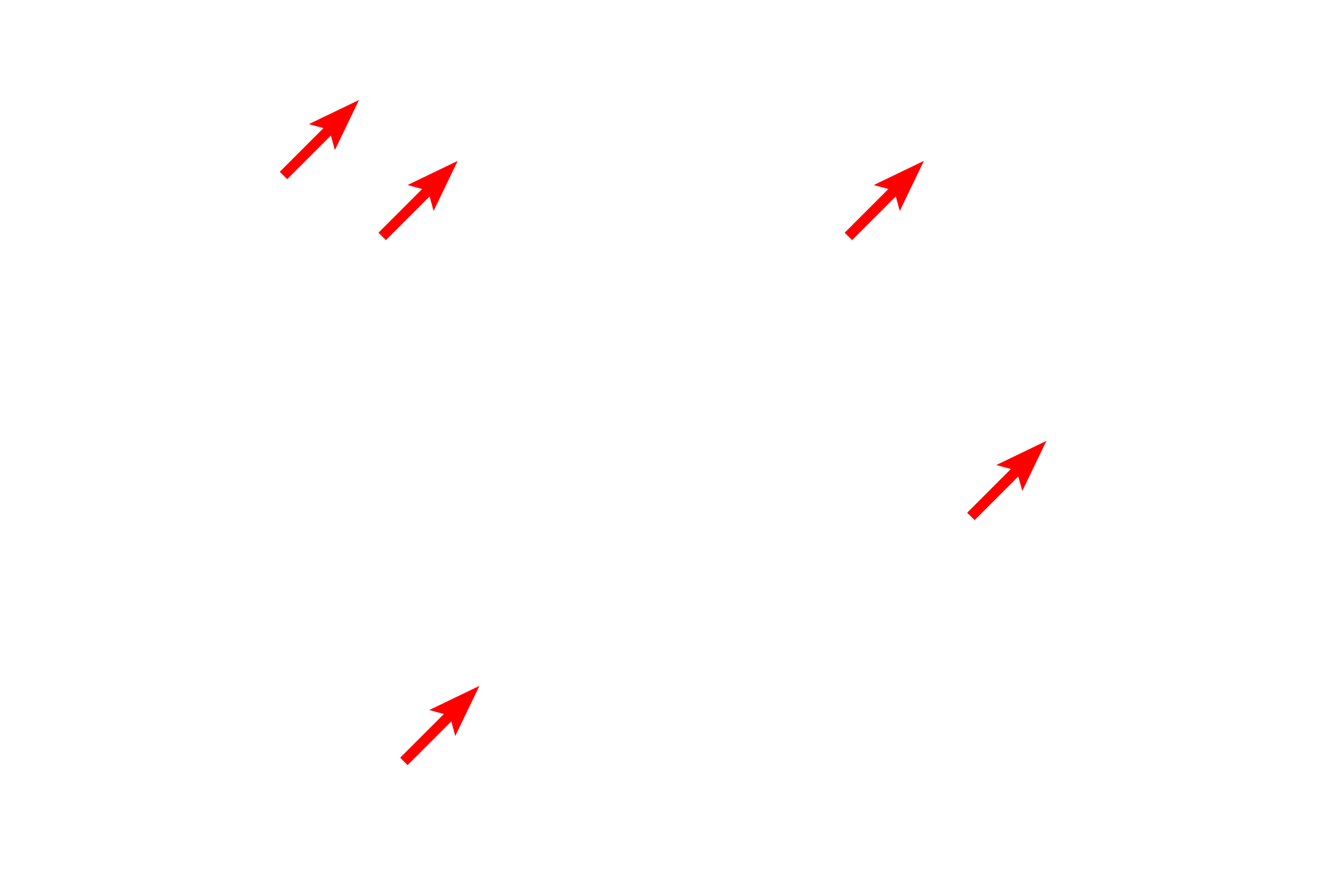 Intermediate filaments <p>Intermediate filaments are 8-10 nm in diameter and occur singly or in bundles, as shown in this micrograph.  Intermediate filaments primarily provide support for the cell and are biochemically and structurally diverse among different cell types.  In this image, the filaments are composed of the protein keratin and form tonofilaments in the epidermis.  Skin  15,000x</p>
