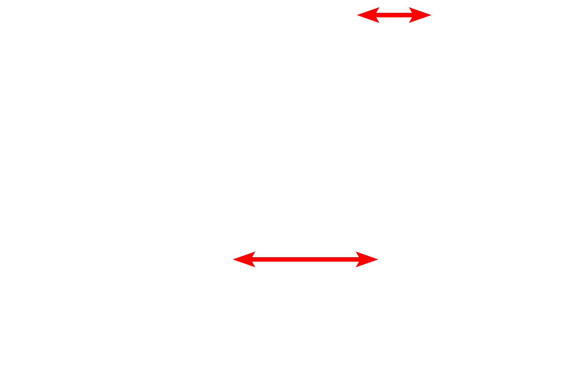 Nuclei <p>Intermediate filaments are 8-10 nm in diameter and occur singly or in bundles, as shown in this micrograph.  Intermediate filaments primarily provide support for the cell and are biochemically and structurally diverse among different cell types.  In this image, the filaments are composed of the protein keratin and form tonofilaments in the epidermis.  Skin  15,000x</p>
