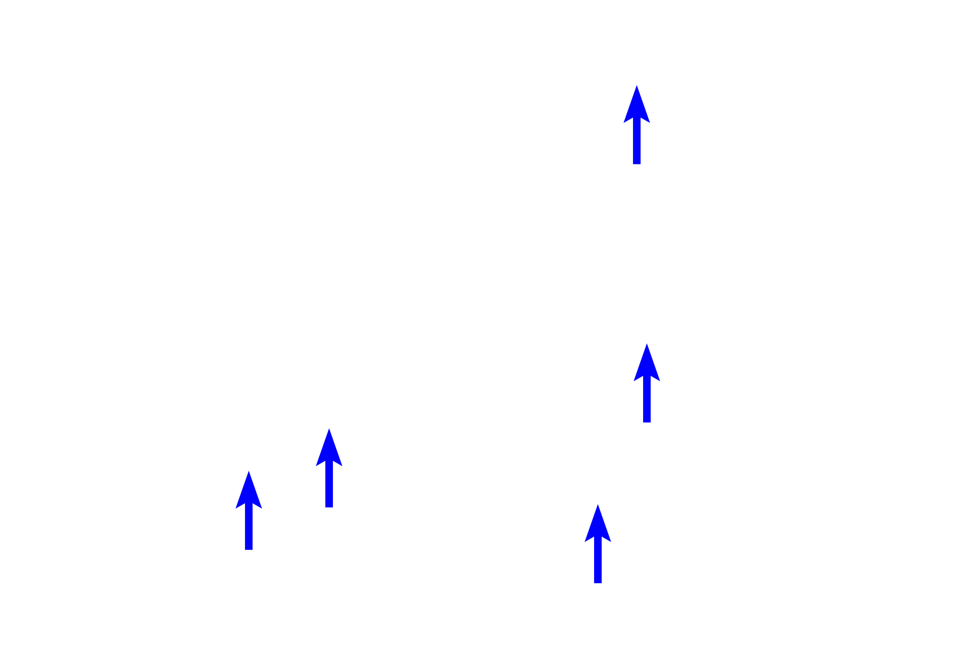 Intermediate filaments and microtubules <p>These complex nerve cells demonstrate an extensive cytoskeleton.  This silver-stained section reveals large, intracellular bundles composed of intermediate filaments (neurofilaments) and microtubules.  1000x</p>
