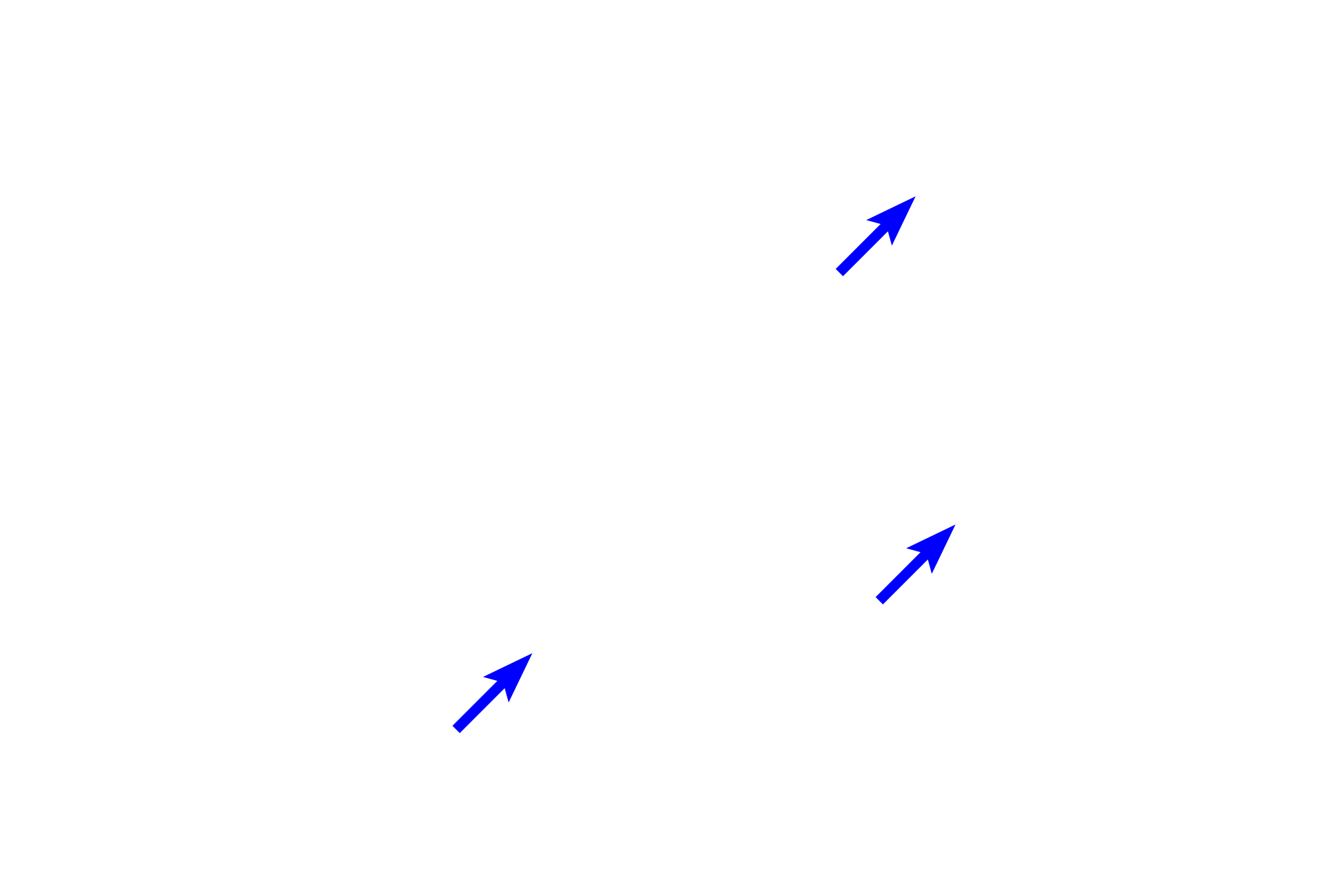 Nuclei <p>These complex nerve cells demonstrate an extensive cytoskeleton.  This silver-stained section reveals large, intracellular bundles composed of intermediate filaments (neurofilaments) and microtubules.  1000x</p>
