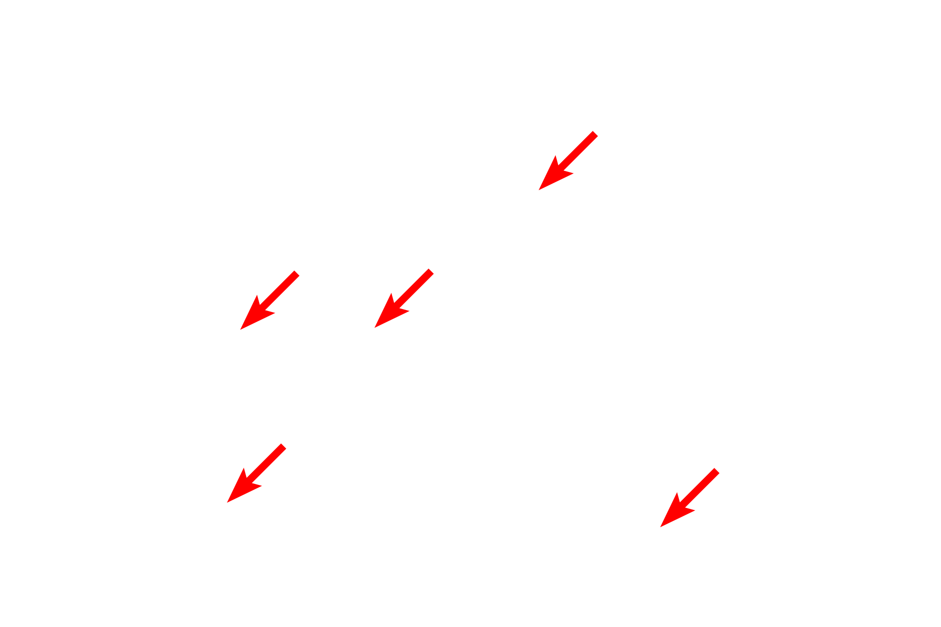 Polysomes <p>This electron micrograph shows a cell with ribosomes arranged predominately as polysomes rather than in association with RER.  Proteins manufactured by polysomes are not packaged into secretory granules but are released into the cytoplasm for intracellular use.  15,000x</p>
