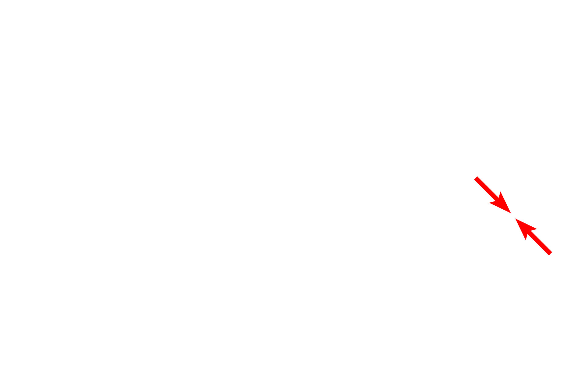  - Nuclear envelope <p>This electron micrograph shows a cell with ribosomes arranged predominately as polysomes rather than in association with RER.  Proteins manufactured by polysomes are not packaged into secretory granules but are released into the cytoplasm for intracellular use.  15,000x</p>
