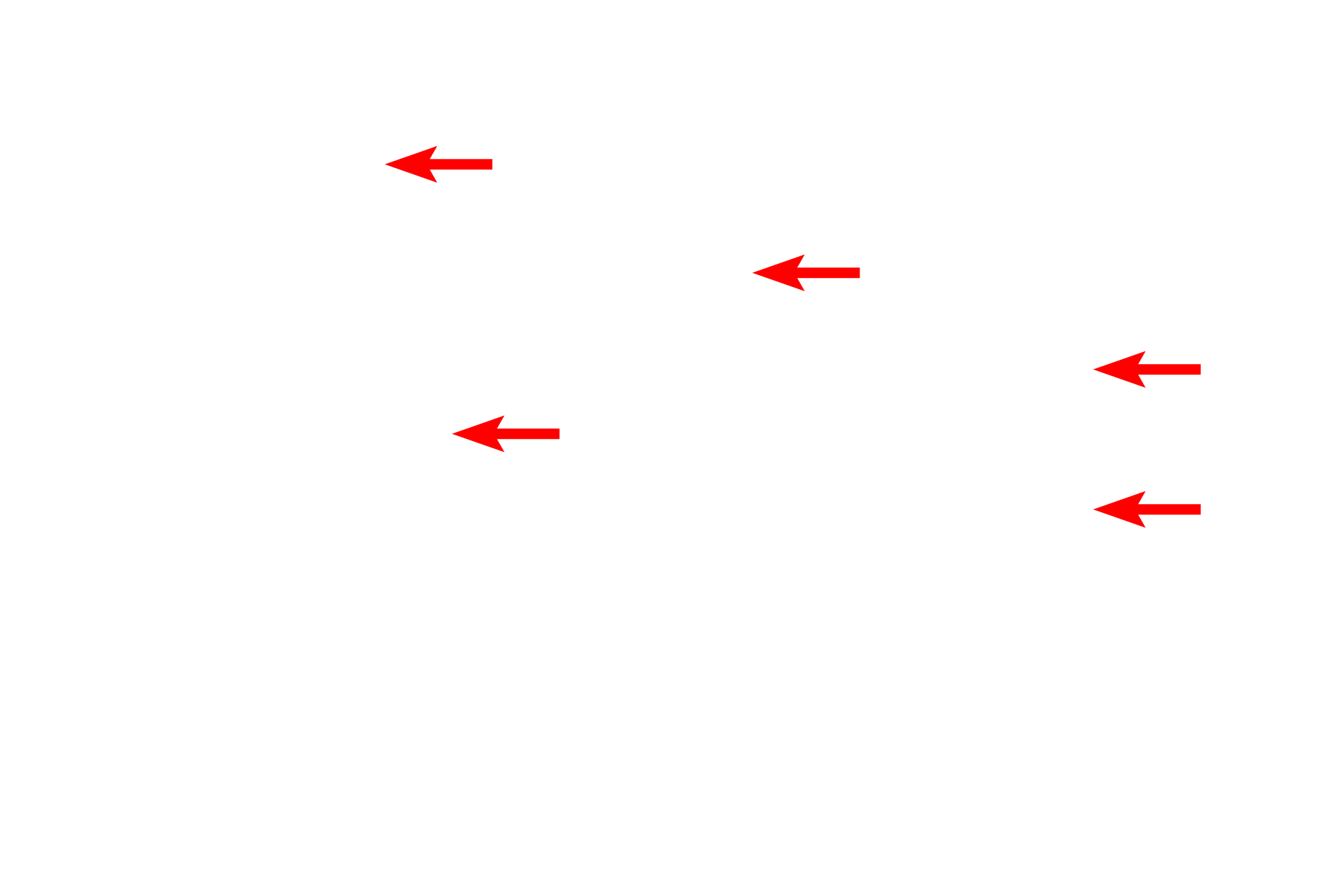 SER <p>Smooth endoplasmic reticulum (SER) is continuous with the RER but is arranged as sacs and tubules that lack ribosomes.  SER is the major site of lipid and cholesterol synthesis and thus is well developed in this steroid hormone-secreting cell.  Another feature of steroid-producing cells are mitochondria with tubular cristae.  The SER also functions in detoxification of drugs and pesticides and plays a role in calcium storage and release. Adrenal cortex  40,000x</p>
