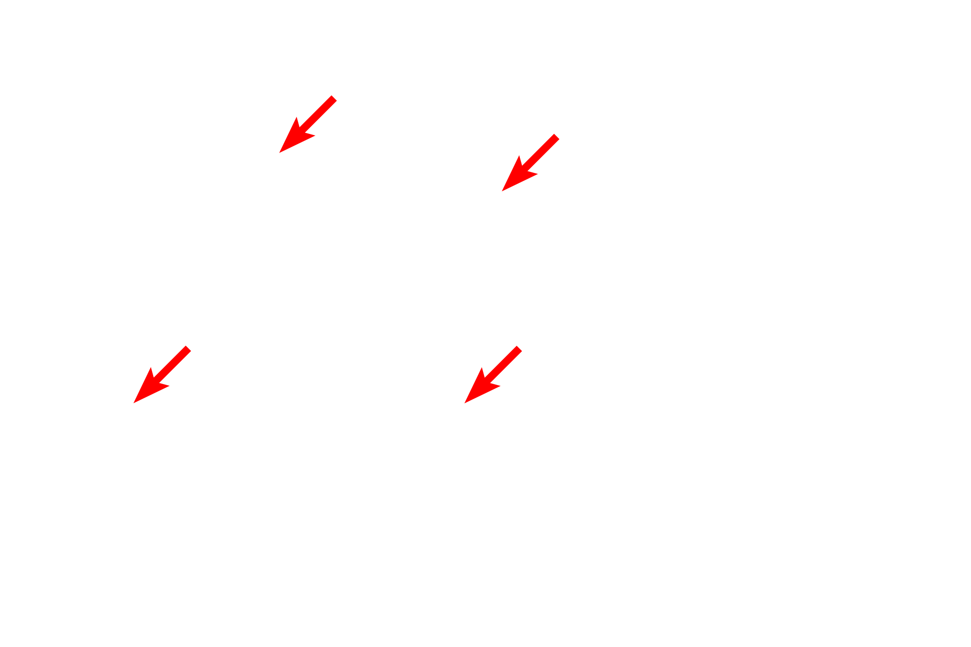 RER <p>SER consists of interconnected tubules and is the major site of lipid synthesis and calcium storage in the cell.  The majority of the SER in this field is cut in cross section and, thus, appears as circular profiles.  The amount of SER in a cell varies greatly depending on the function of the cell, e.g., SER is abundant in steroid secreting cells and liver cells (hepatocytes) for detoxification.  25,000x</p>
