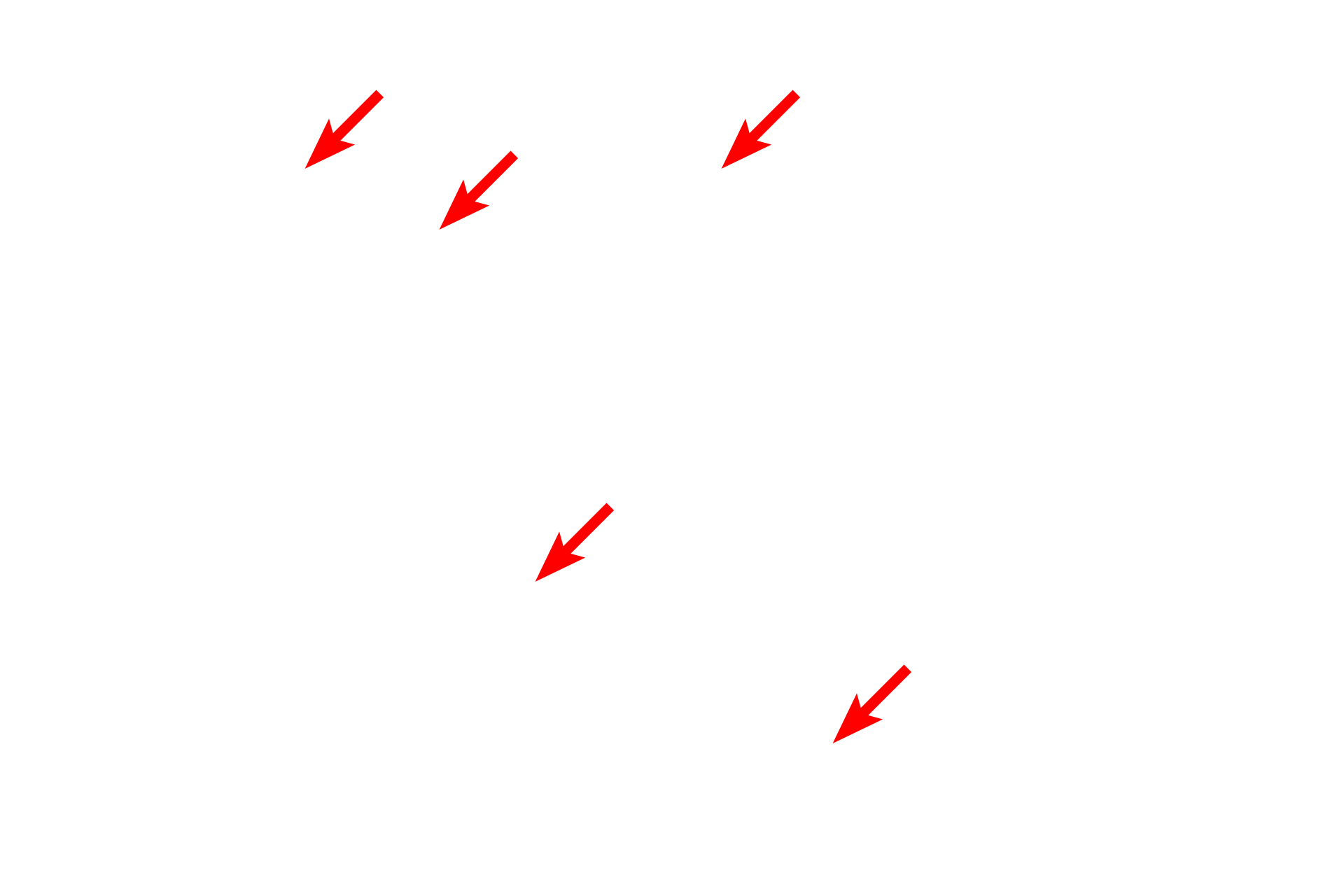  - Secretory granules <p>At the EM level, large accumulations of RER can be seen at the base of the cell.  The nucleus is also in the cell base, while secretory granules are in the apex, waiting release into the duct of the gland.  The segregation of the RER and secretory granules results in cell polarity, indicating the cell is making protein for exocrine secretion.  Pancreas  4000x</p>
