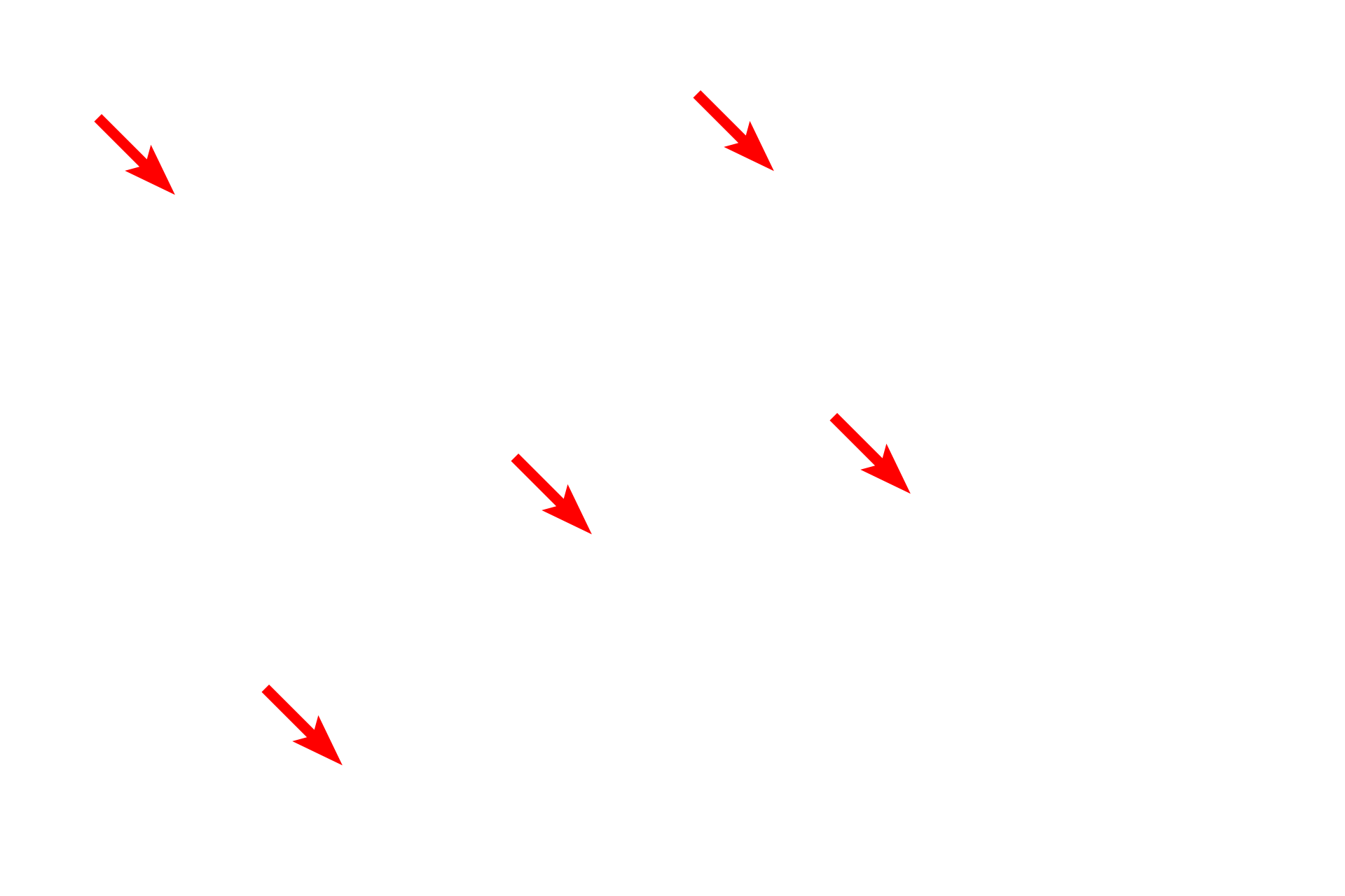 Mitochondria <p>This electron micrograph shows a cell with extensive RER, indicating that it is actively synthesizing protein (translation) for secretion.  At the light microscopic level, these regions of RER stain blue with hematoxylin.  Also visible are mitochondria, lipid droplets, glycogen granules and a portion of the nucleus.  Liver  8000x</p>

