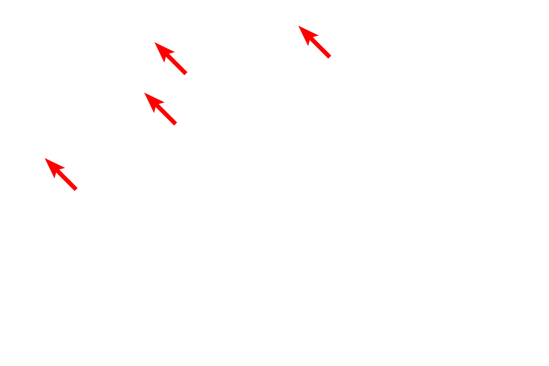 Lipid droplets <p>This electron micrograph shows a cell with extensive RER, indicating that it is actively synthesizing protein (translation) for secretion.  At the light microscopic level, these regions of RER stain blue with hematoxylin.  Also visible are mitochondria, lipid droplets, glycogen granules and a portion of the nucleus.  Liver  8000x</p>
