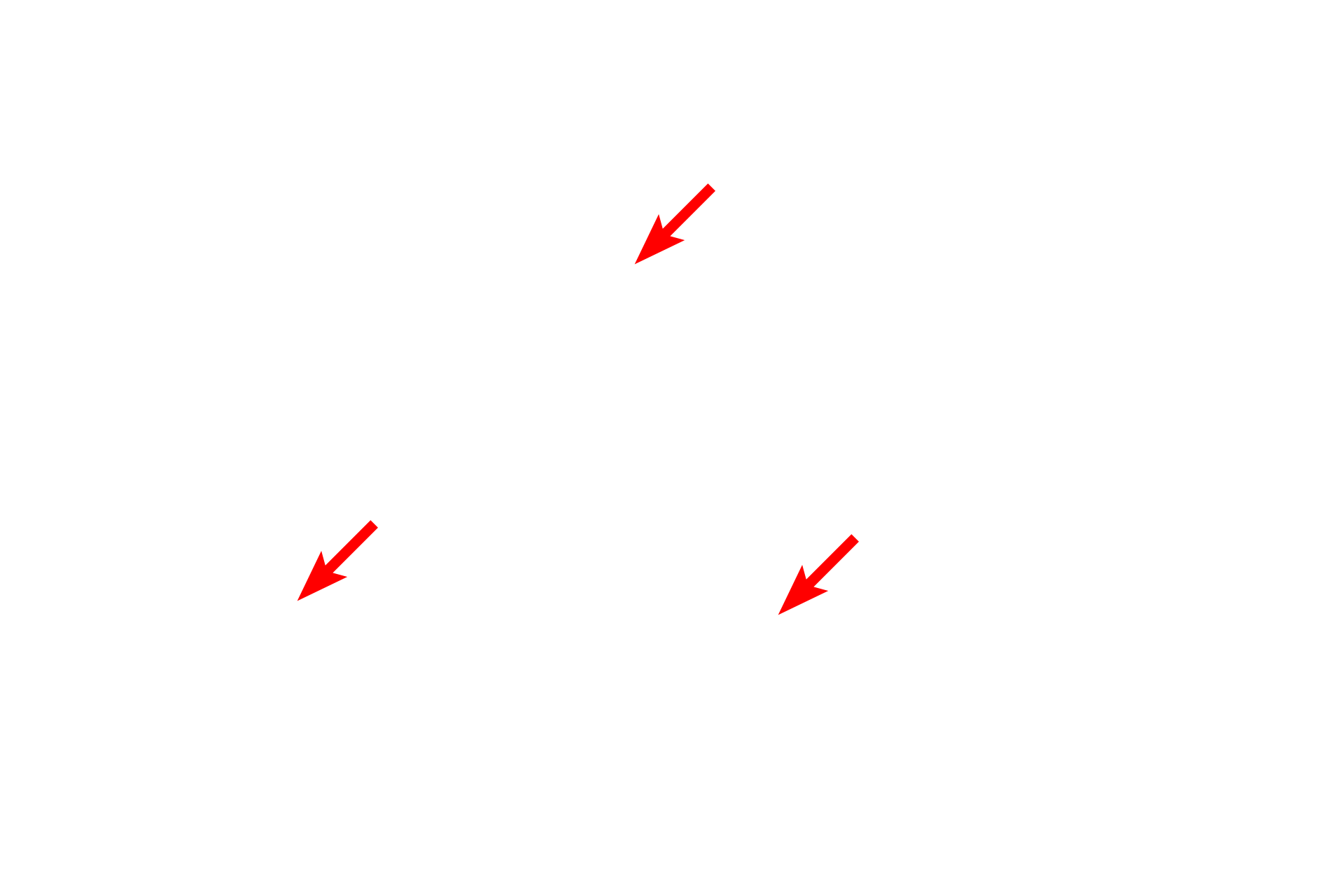 Glycogen <p>This electron micrograph shows a cell with extensive RER, indicating that it is actively synthesizing protein (translation) for secretion.  At the light microscopic level, these regions of RER stain blue with hematoxylin.  Also visible are mitochondria, lipid droplets, glycogen granules and a portion of the nucleus.  Liver  8000x</p>
