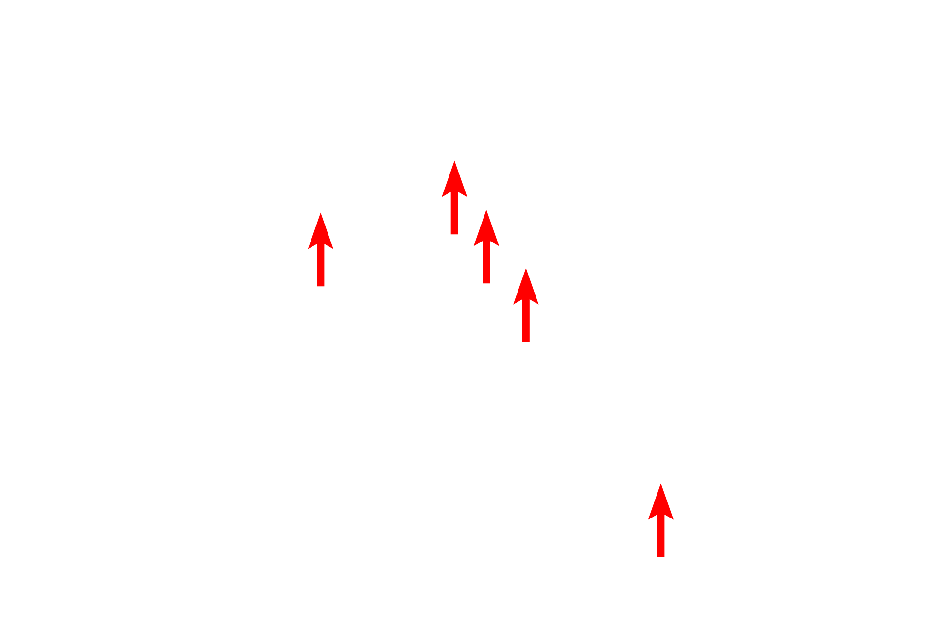  - Ribosomes <p>The amount of RER in a cell varies depending on the function of the cell.  This image shows portions of four RER cisterns in a cell with a modest amount of overall RER.  The closely apposed plasma membranes of two adjacent cells are also visible.  45,000x</p>
