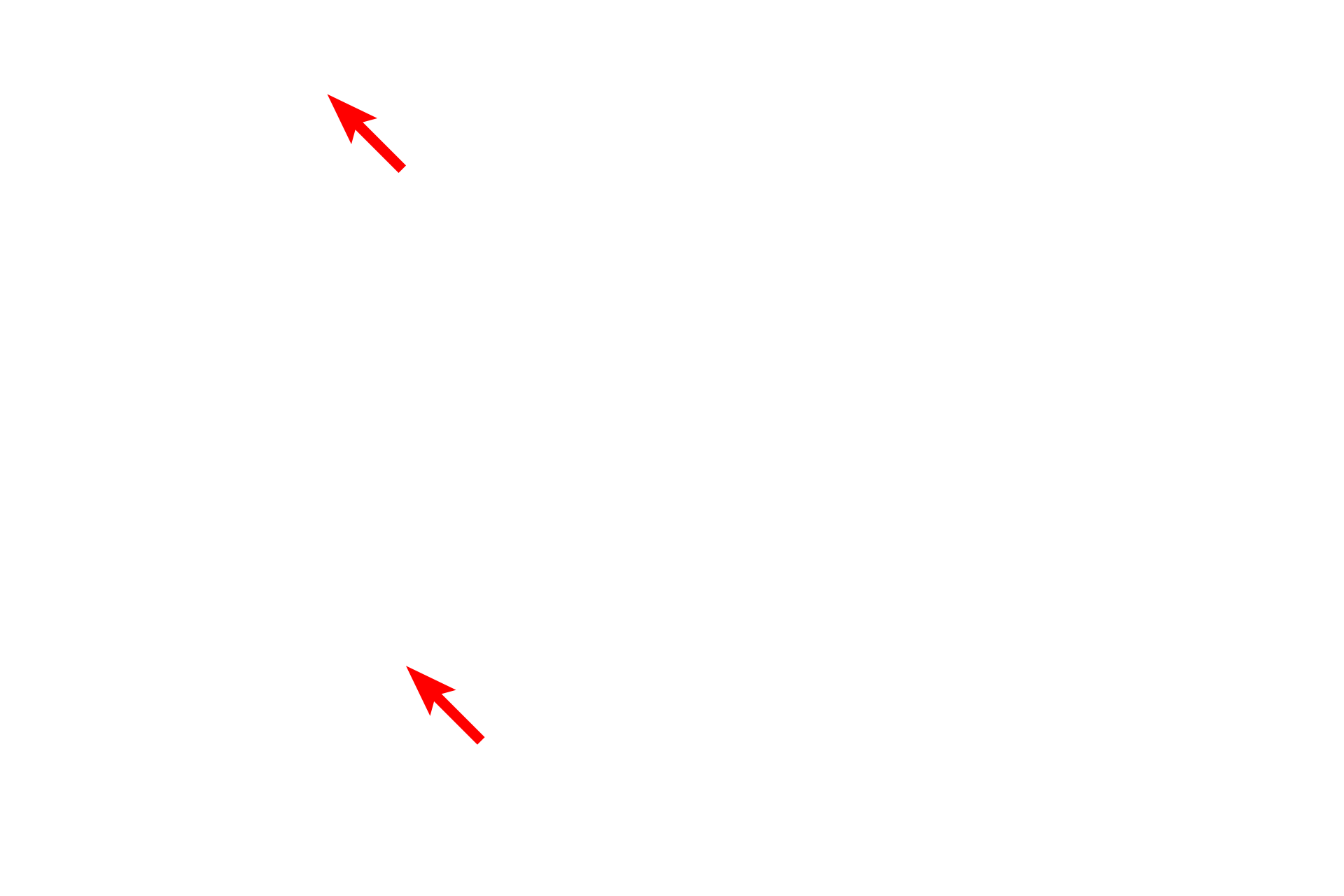 Mitochondria <p>The amount of RER in a cell varies depending on the function of the cell.  This image shows portions of four RER cisterns in a cell with a modest amount of overall RER.  The closely apposed plasma membranes of two adjacent cells are also visible.  45,000x</p>
