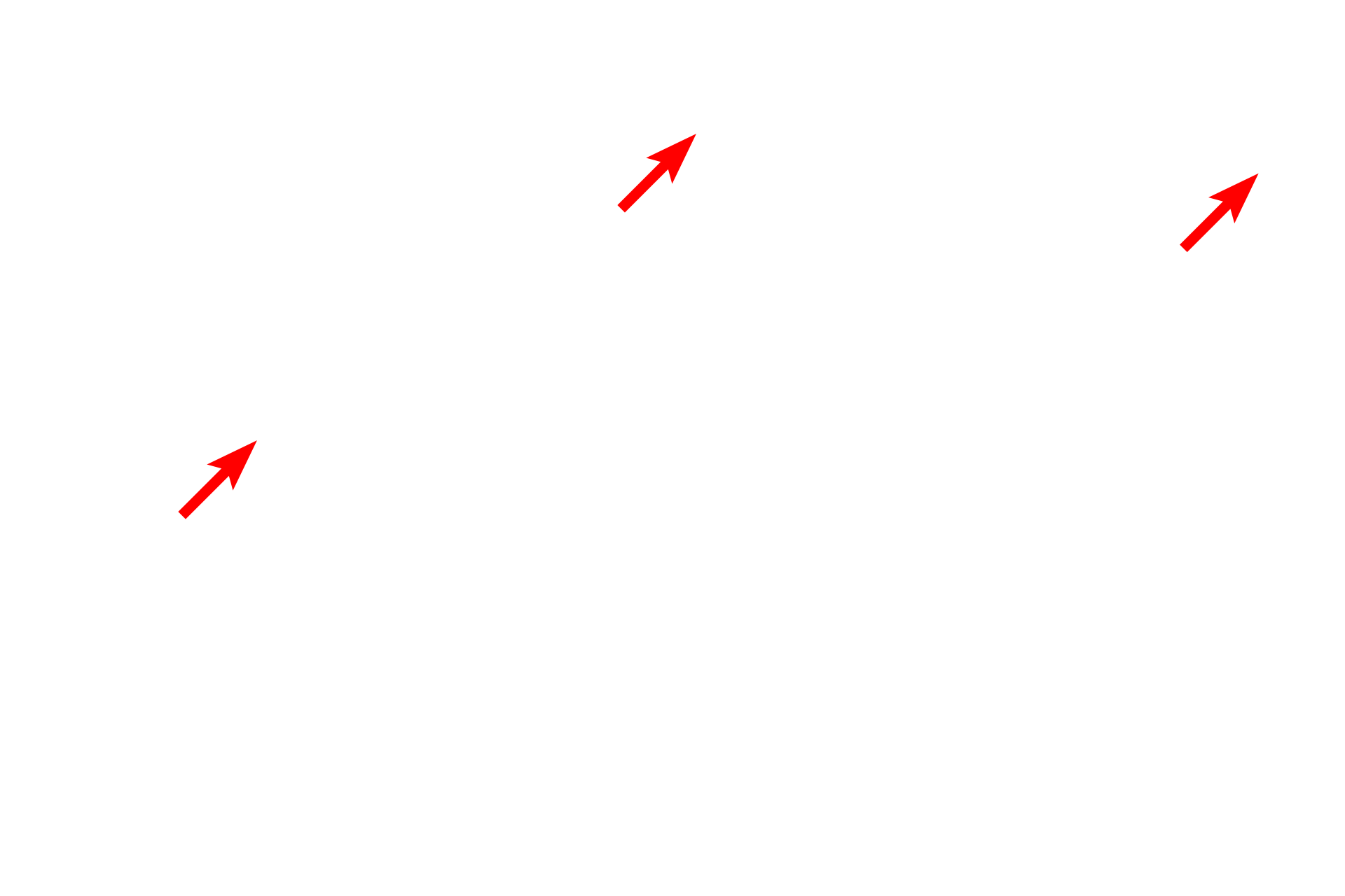 Polysomes <p>The amount of RER in a cell varies depending on the function of the cell.  This image shows portions of four RER cisterns in a cell with a modest amount of overall RER.  The closely apposed plasma membranes of two adjacent cells are also visible.  45,000x</p>
