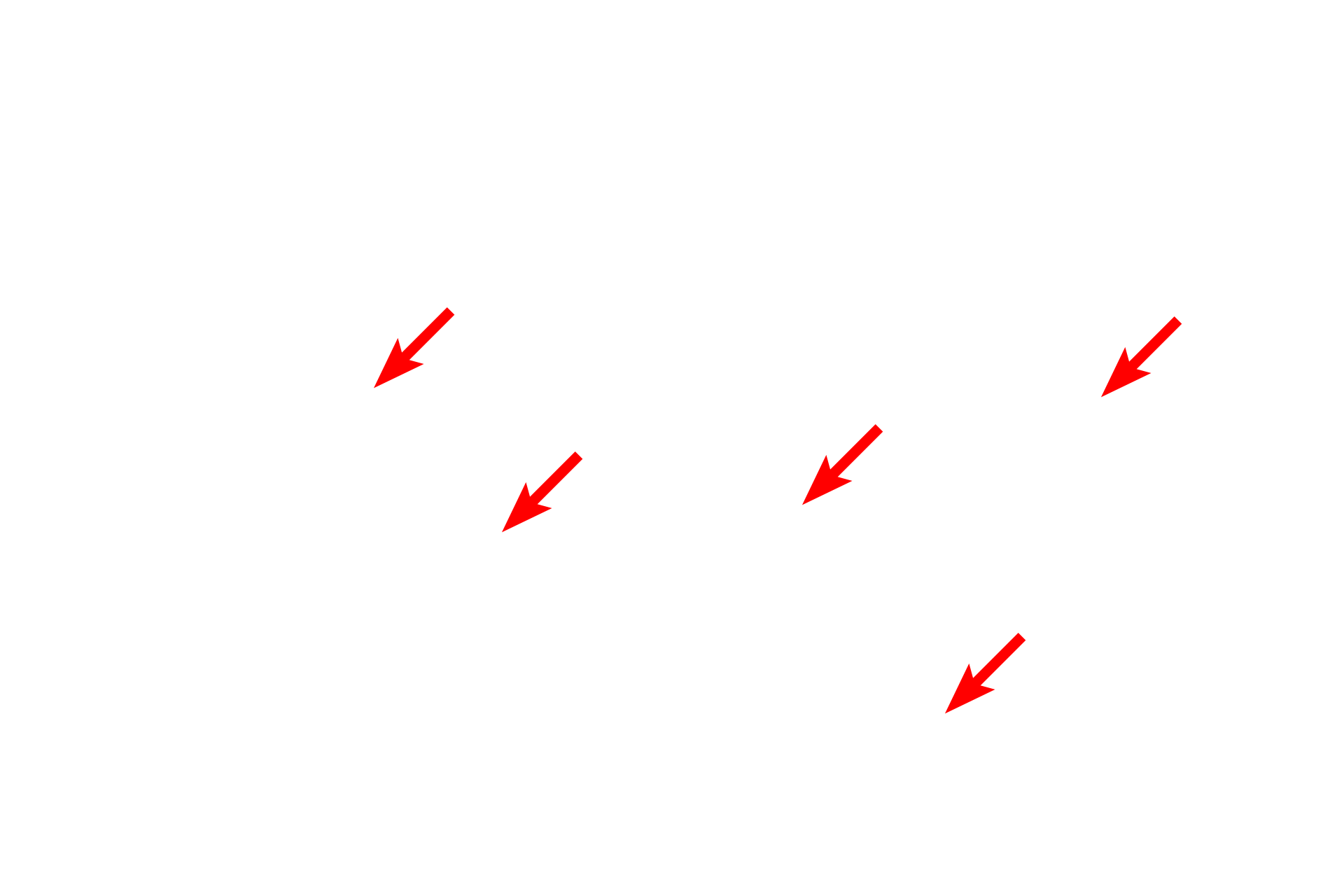  - Cistern lumen <p>In actively secreting cells, the RER is very extensive and consists of large numbers of interconnecting, flattened sacs or cisterns.  Also visible in this field is the nuclear envelope showing ribosomes on the cytoplasmic surface of the outer nuclear membrane.  Mitochondria and lipid droplets are also present.  40,000x</p>
