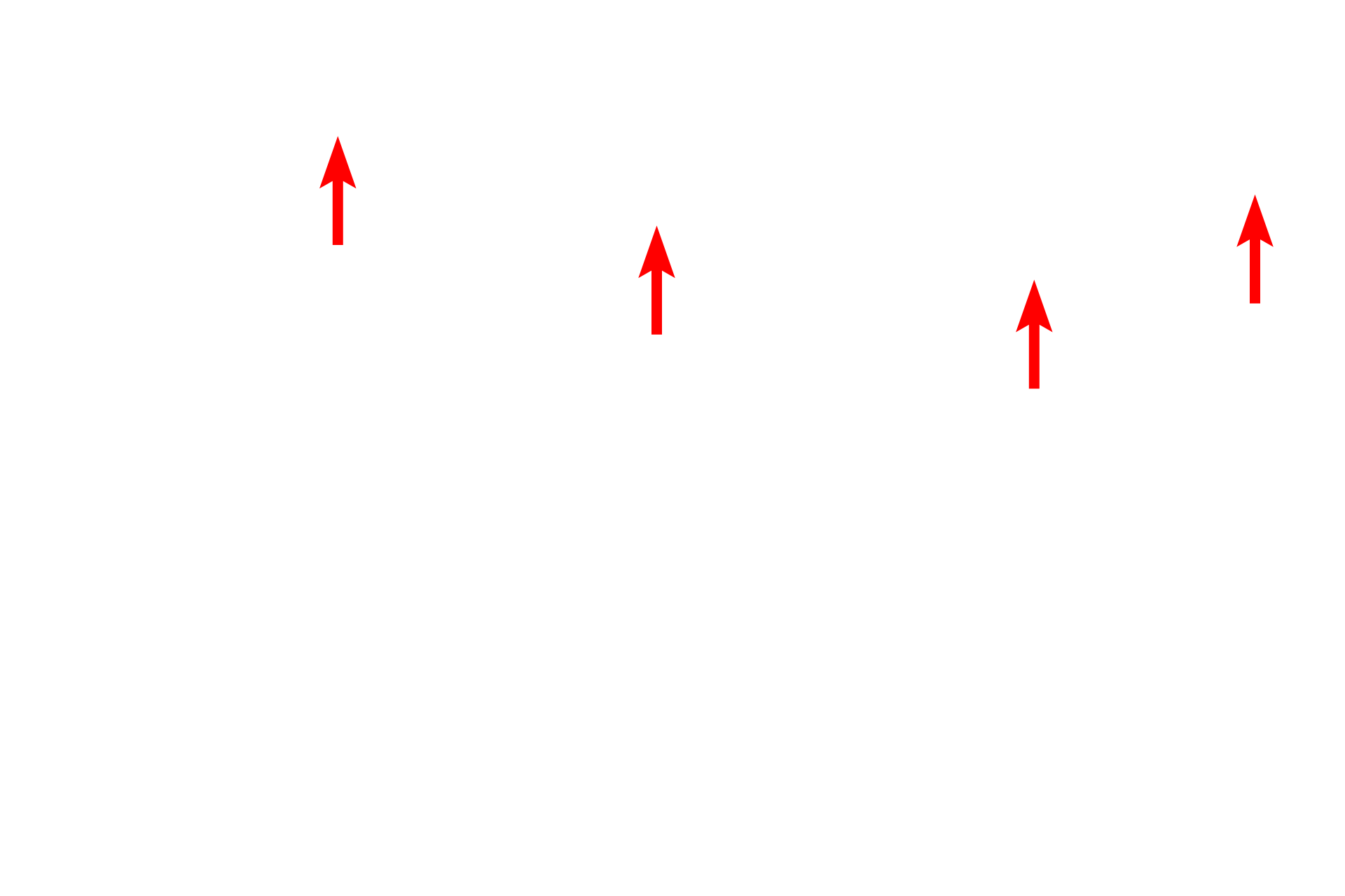 Outer nuclear membrane <p>In actively secreting cells, the RER is very extensive and consists of large numbers of interconnecting, flattened sacs or cisterns.  Also visible in this field is the nuclear envelope showing ribosomes on the cytoplasmic surface of the outer nuclear membrane.  Mitochondria and lipid droplets are also present.  40,000x</p>
