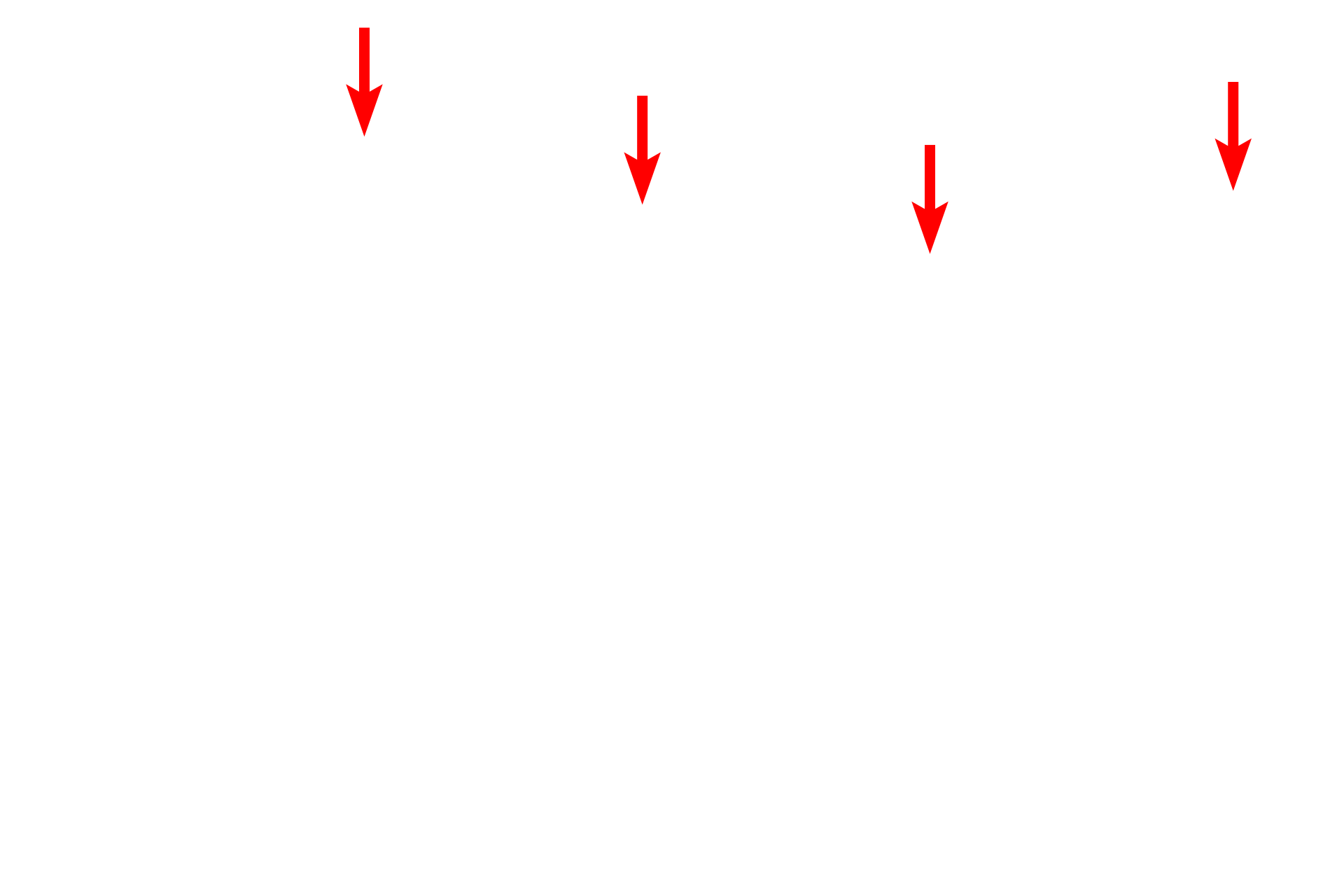 Inner nuclear membrane <p>In actively secreting cells, the RER is very extensive and consists of large numbers of interconnecting, flattened sacs or cisterns.  Also visible in this field is the nuclear envelope showing ribosomes on the cytoplasmic surface of the outer nuclear membrane.  Mitochondria and lipid droplets are also present.  40,000x</p>
