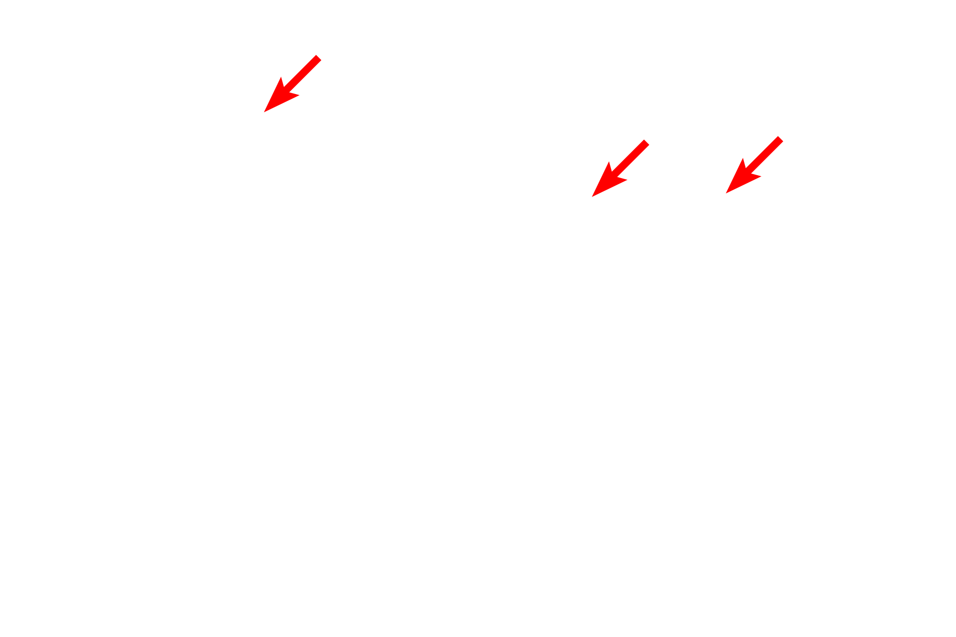 Perinuclear space <p>In actively secreting cells, the RER is very extensive and consists of large numbers of interconnecting, flattened sacs or cisterns.  Also visible in this field is the nuclear envelope showing ribosomes on the cytoplasmic surface of the outer nuclear membrane.  Mitochondria and lipid droplets are also present.  40,000x</p>
