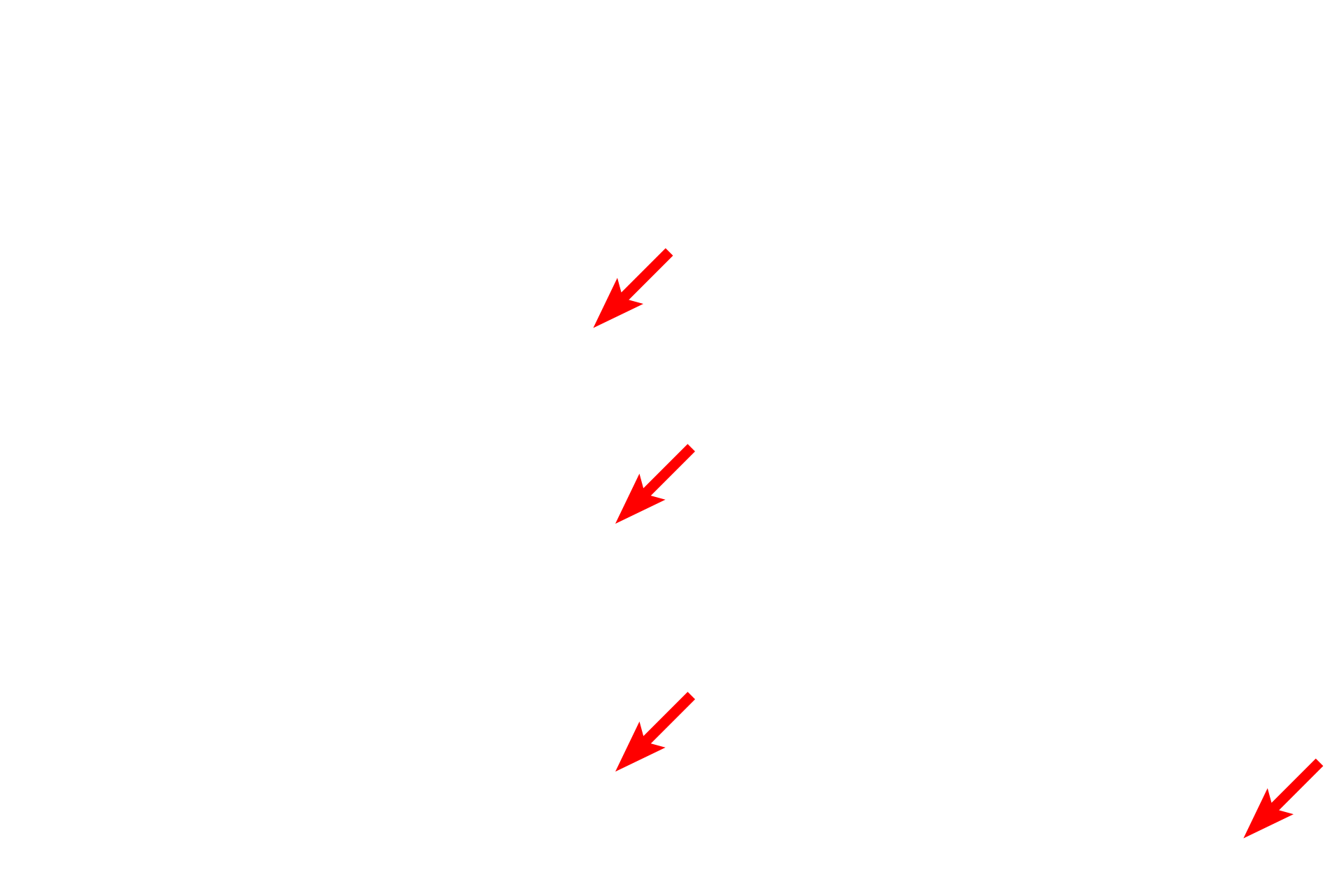 Ribosomes on RER <p>This electron micrograph shows a cell with RER and many polysomes, or polyribosomes.  Polysomes are groups of ribosomes attached to a single messenger RNA molecule that synthesize protein for internal use by the cell.  30,000x</p>
