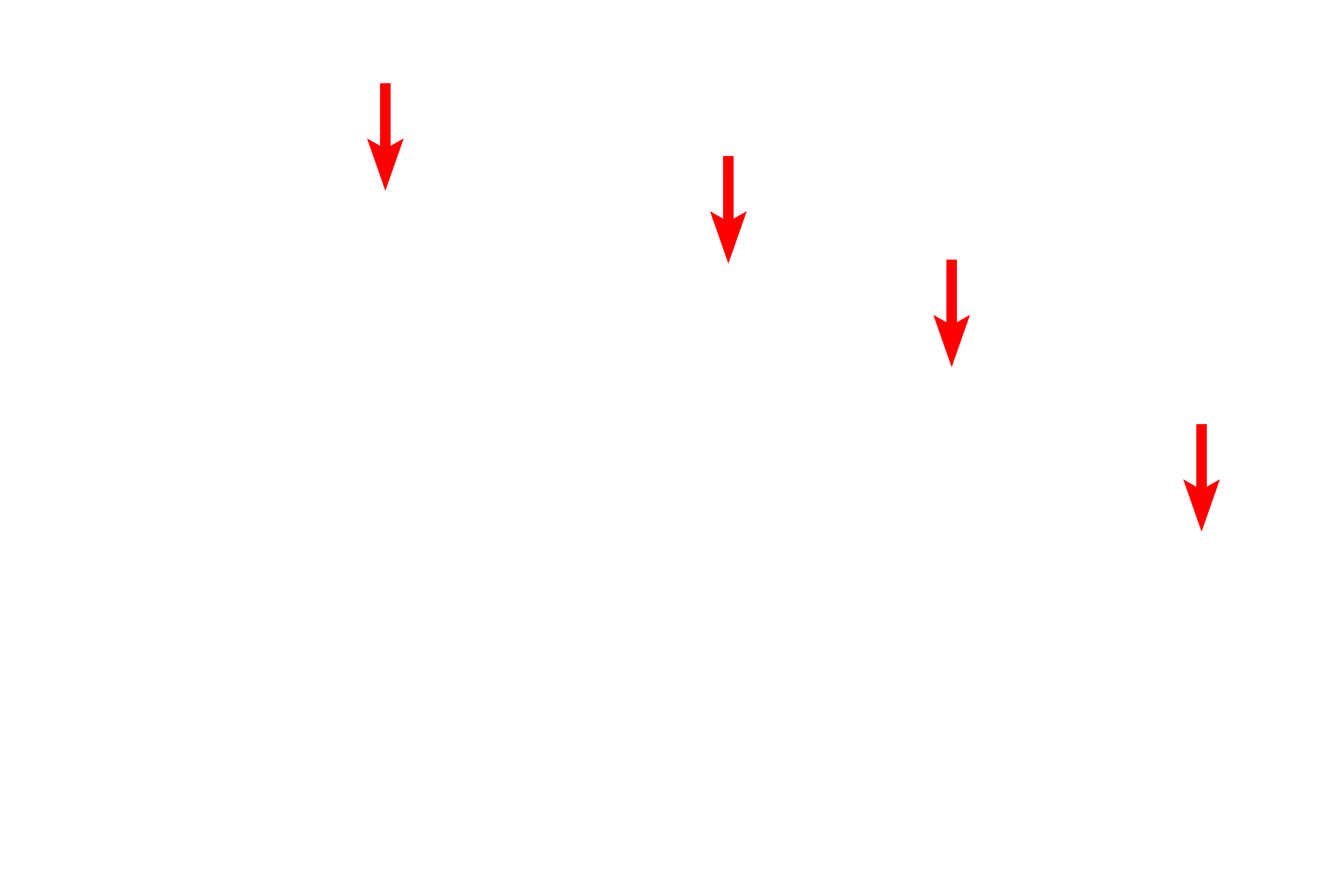 Plasma membrane <p>This electron micrograph shows a cell with RER and many polysomes, or polyribosomes.  Polysomes are groups of ribosomes attached to a single messenger RNA molecule that synthesize protein for internal use by the cell.  30,000x</p>
