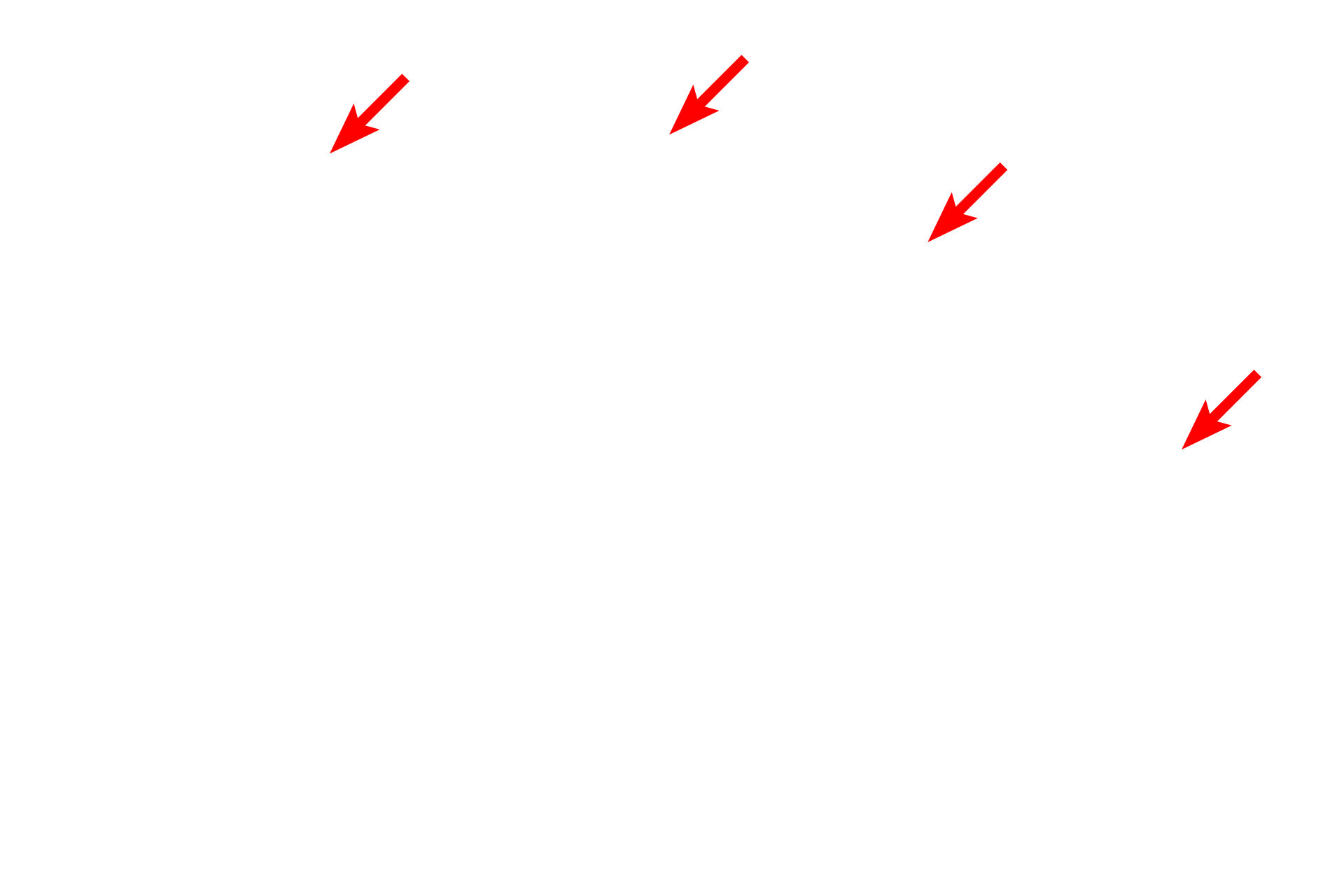 Intercellular space <p>This electron micrograph shows a cell with RER and many polysomes, or polyribosomes.  Polysomes are groups of ribosomes attached to a single messenger RNA molecule that synthesize protein for internal use by the cell.  30,000x</p>
