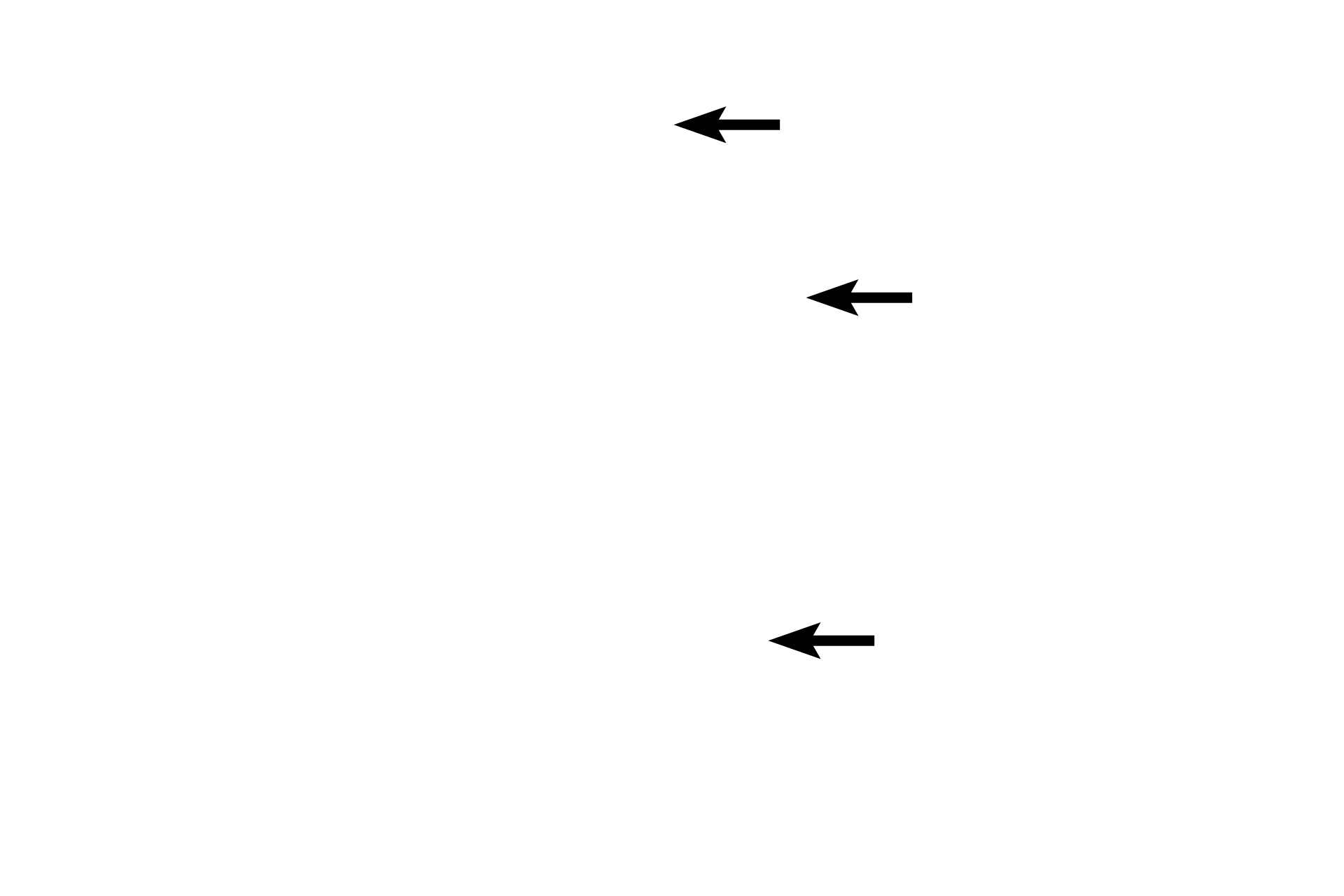  - RER <p>Only large accumulations of RER can be identified at the LM level.  This cluster of pancreatic cells shows basophilic RER (blue staining) at the base of each wedge-shaped cell.  RER manufactures proteins for export that are packaged by the Golgi as secretory granules.  These granules accumulate in the cell apex for release from the cell.  1000x</p>
