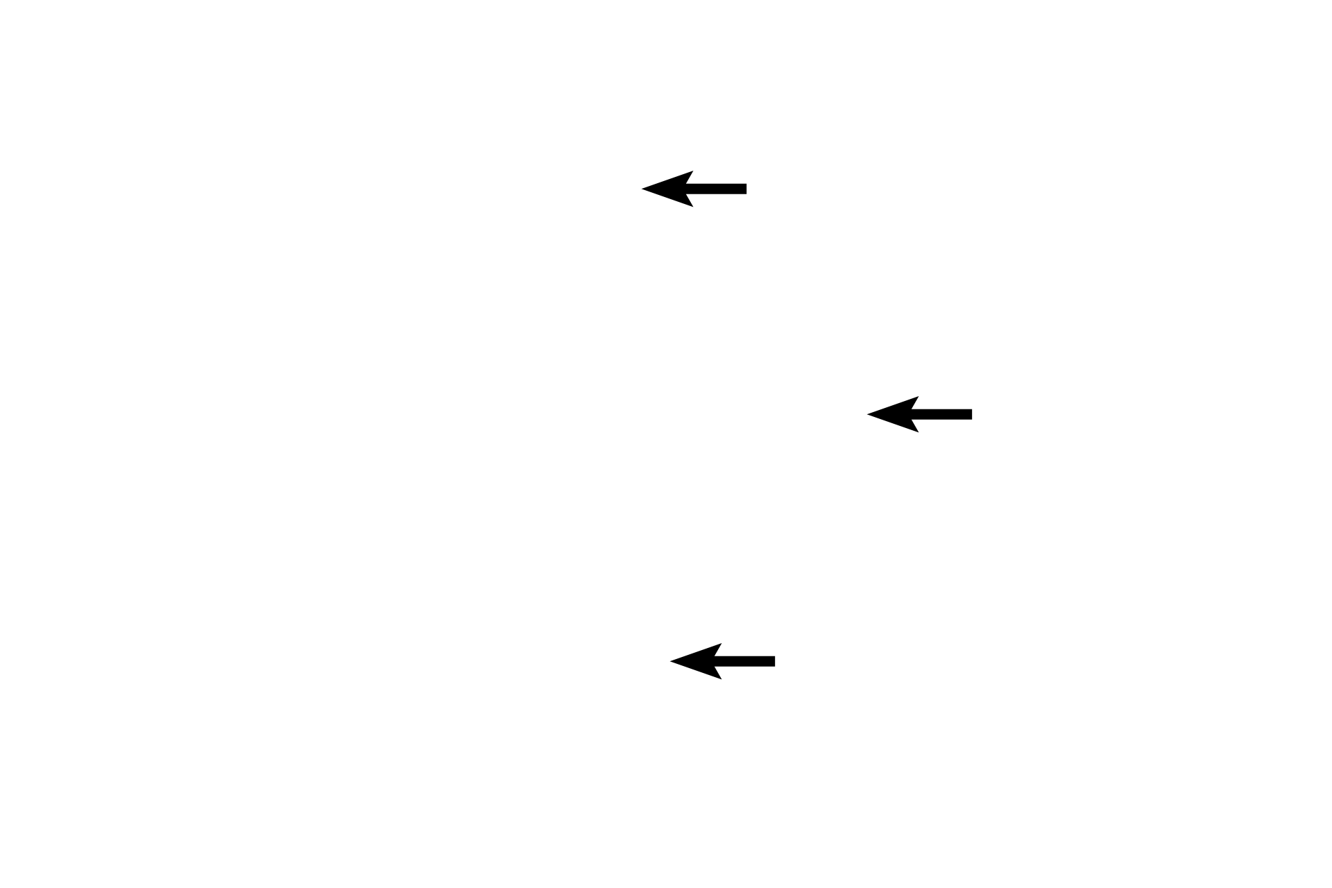  - Nuclei <p>Only large accumulations of RER can be identified at the LM level.  This cluster of pancreatic cells shows basophilic RER (blue staining) at the base of each wedge-shaped cell.  RER manufactures proteins for export that are packaged by the Golgi as secretory granules.  These granules accumulate in the cell apex for release from the cell.  1000x</p>
