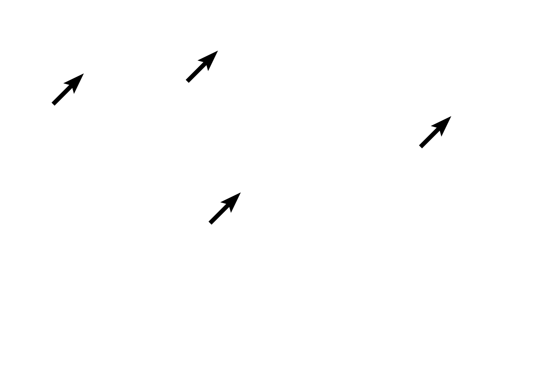  - Secretory granules <p>Only large accumulations of RER can be identified at the LM level.  This cluster of pancreatic cells shows basophilic RER (blue staining) at the base of each wedge-shaped cell.  RER manufactures proteins for export that are packaged by the Golgi as secretory granules.  These granules accumulate in the cell apex for release from the cell.  1000x</p>
