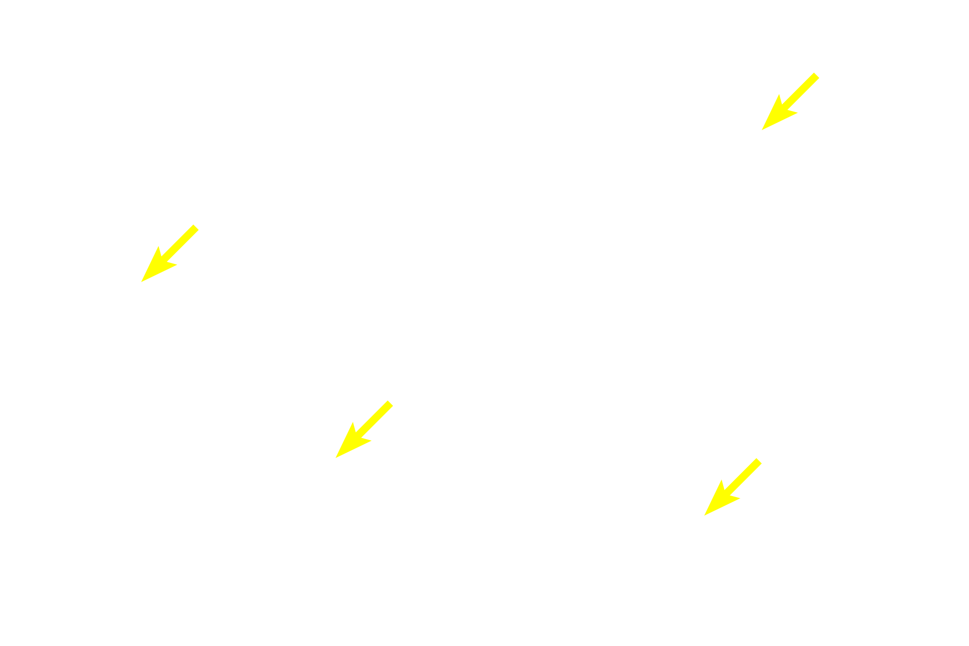 Nuclei <p>Glycogen, the storage form of glucose, is abundant in liver and muscle cells.  At the light microscopic level, the periodic acid-Schiff (PAS) histochemical method stains the carbohydrate glycogen a magenta color.  Here, this stain shows accumulations of glycogen granules in the cytoplasm of liver cells (hepatocytes).  Liver  1000x</p>
