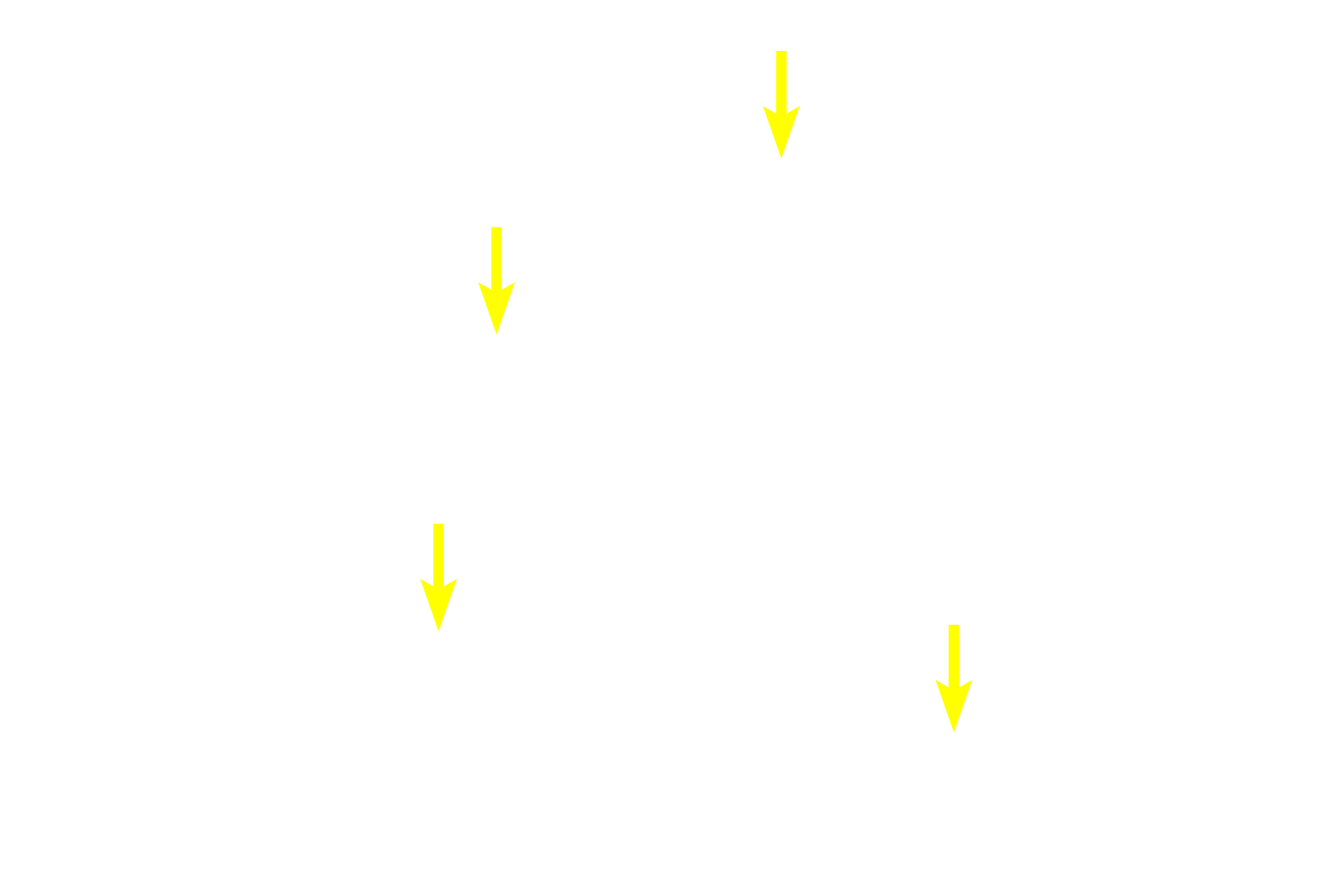  - Nucleoli <p>Glycogen, the storage form of glucose, is abundant in liver and muscle cells.  At the light microscopic level, the periodic acid-Schiff (PAS) histochemical method stains the carbohydrate glycogen a magenta color.  Here, this stain shows accumulations of glycogen granules in the cytoplasm of liver cells (hepatocytes).  Liver  1000x</p>
