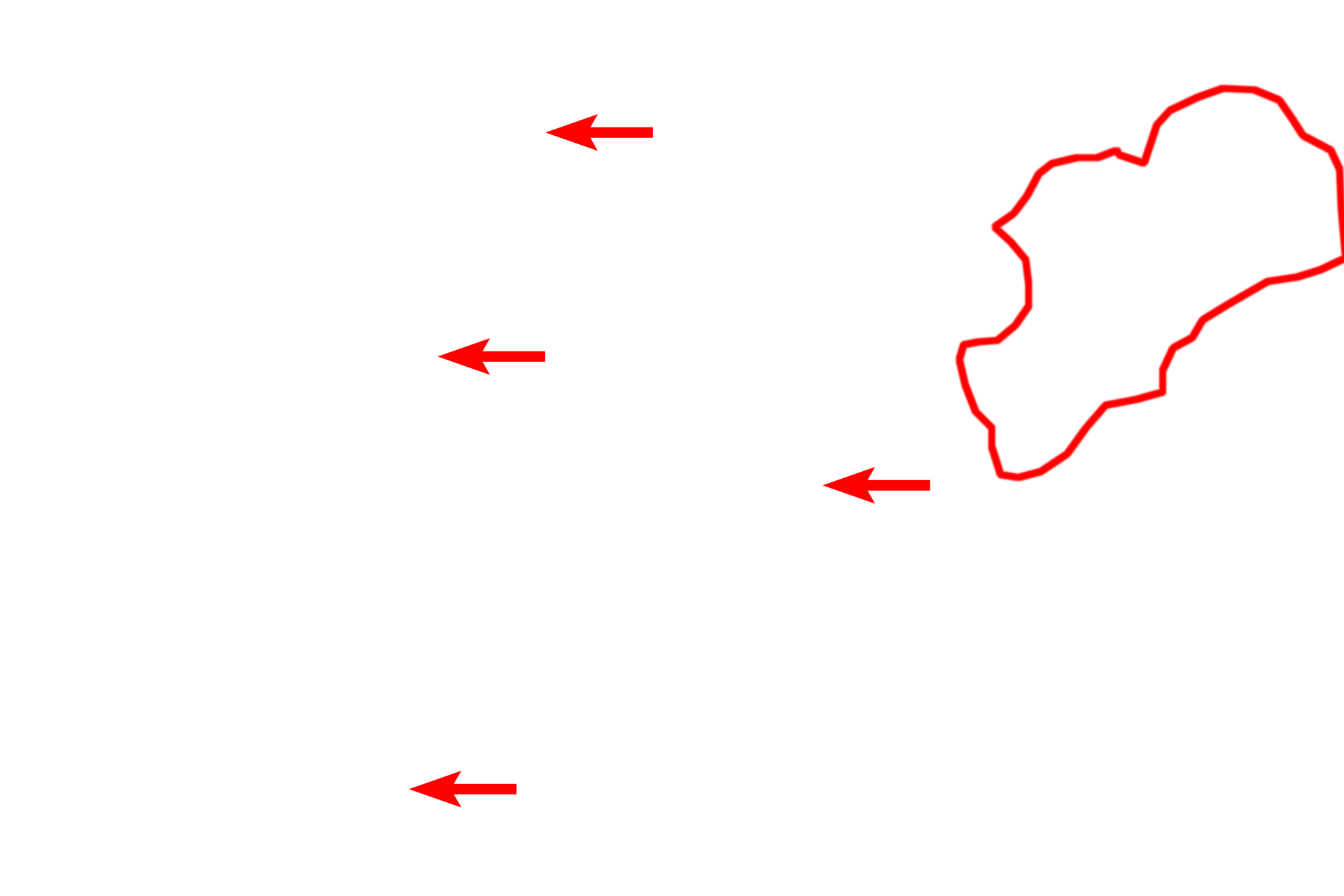 Glycogen granules <p>Individual glycogen granules can be resolved at the ultrastructural level.  They appear as coarse, highly electron-dense structures in the cytoplasm and are not surrounded by a membrane.  A collection of granules is outlined.  Glycogen granules are larger and more electron dense than ribosomes.  Liver  20,000x</p>
