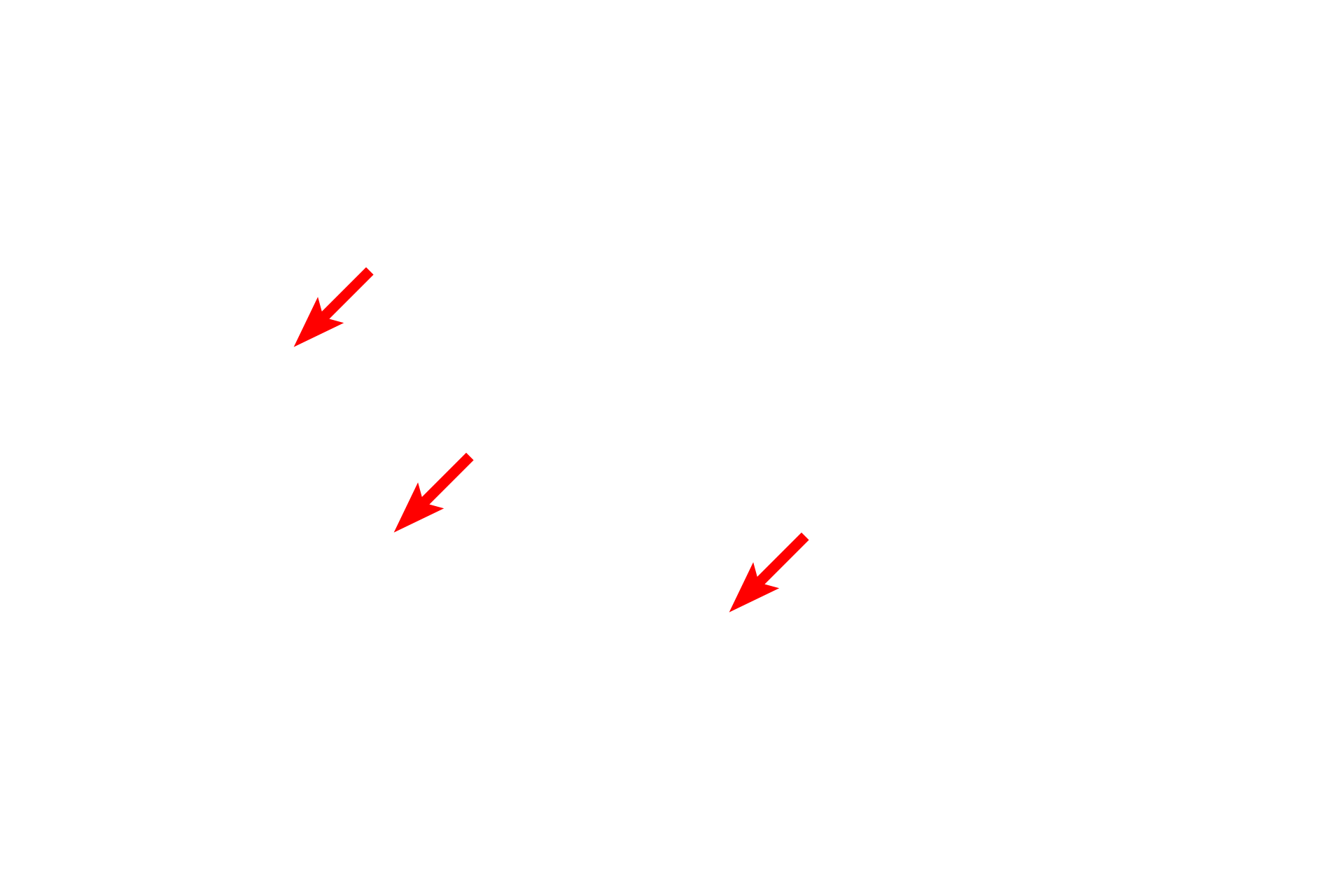 Ribosomes on RER <p>Individual glycogen granules can be resolved at the ultrastructural level.  They appear as coarse, highly electron-dense structures in the cytoplasm and are not surrounded by a membrane.  A collection of granules is outlined.  Glycogen granules are larger and more electron dense than ribosomes.  Liver  20,000x</p>
