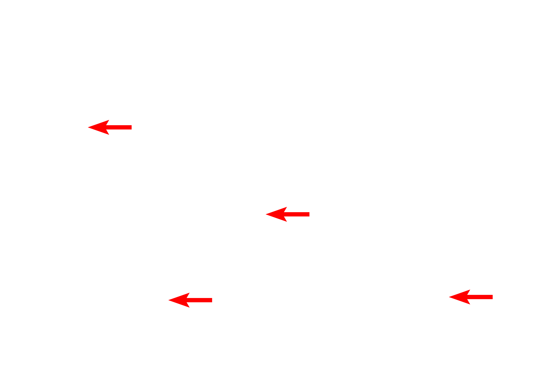 Glycogen granules <p>Individual glycogen granules appear as coarse, highly electron-dense structures in the cytoplasm and are not surrounded by a membrane.  When compared with ribosomes on the RER, glycogen granules are larger and more electron dense.  Liver  40,000x</p>
