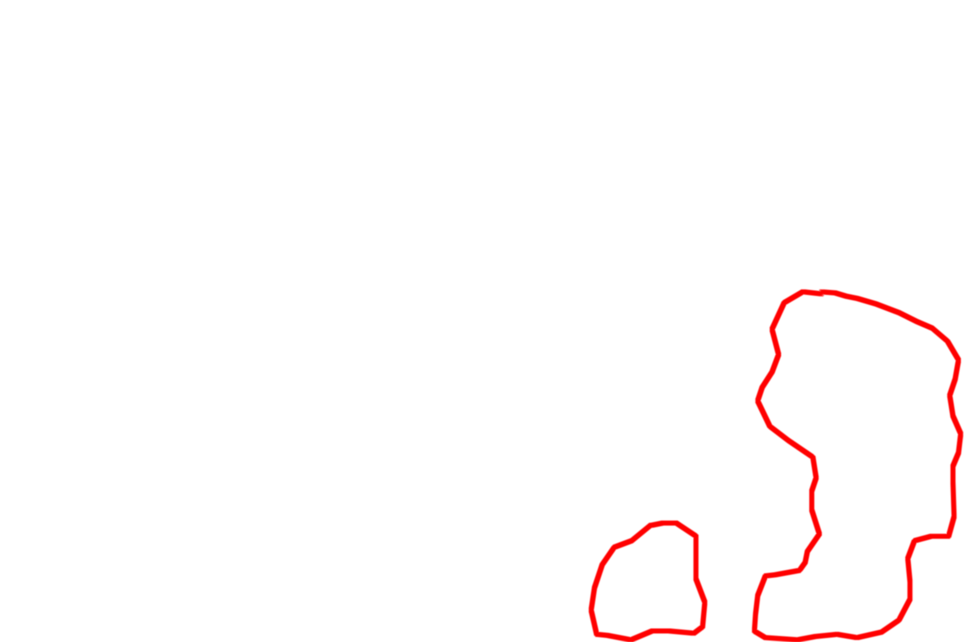 Glycogen granules <p>This electron micrograph of a hepatocyte shows larger, more coarse accumulations of glycogen.  Liver  7500x</p>

