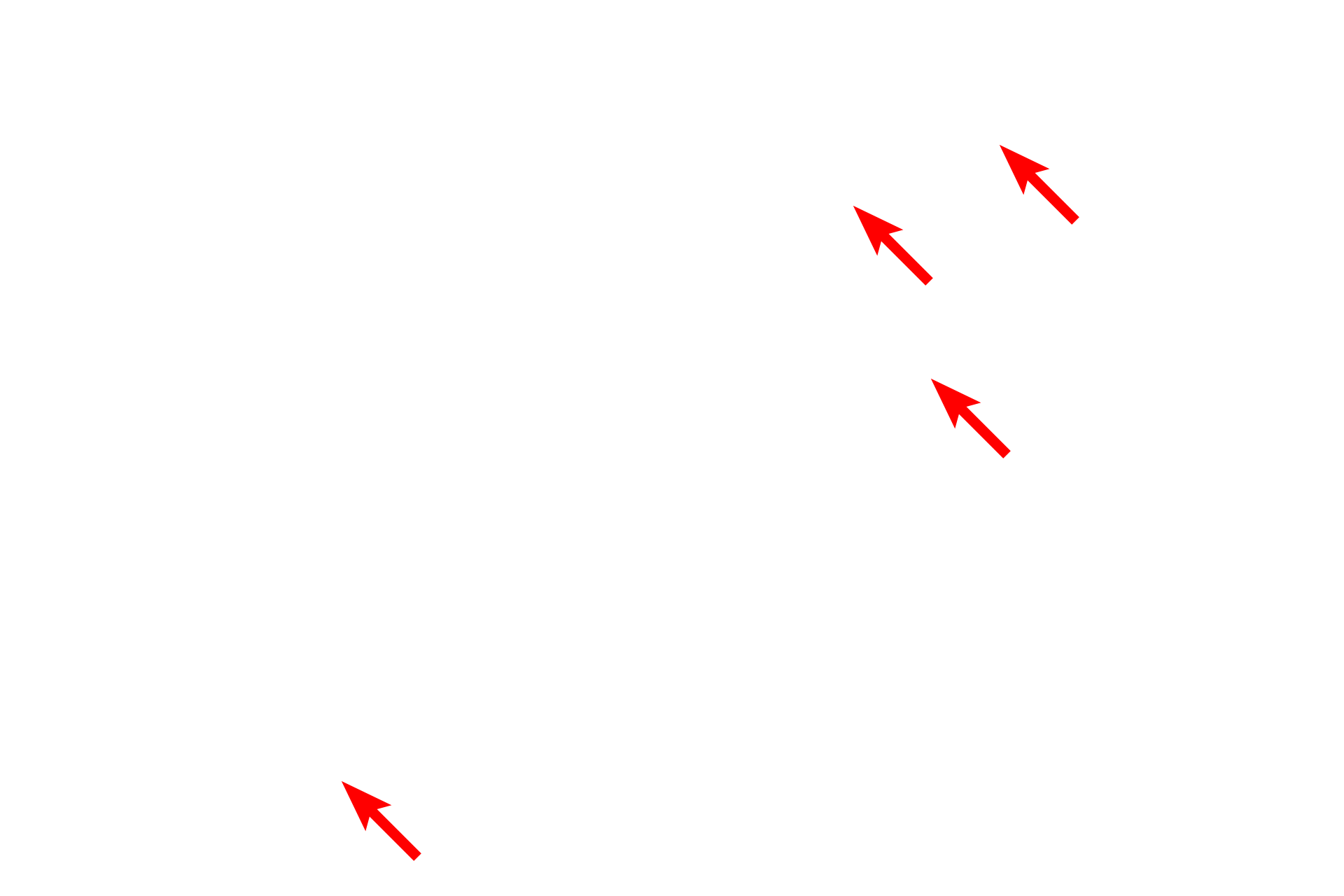 Mitochondria <p>This electron micrograph of a hepatocyte shows larger, more coarse accumulations of glycogen.  Liver  7500x</p>
