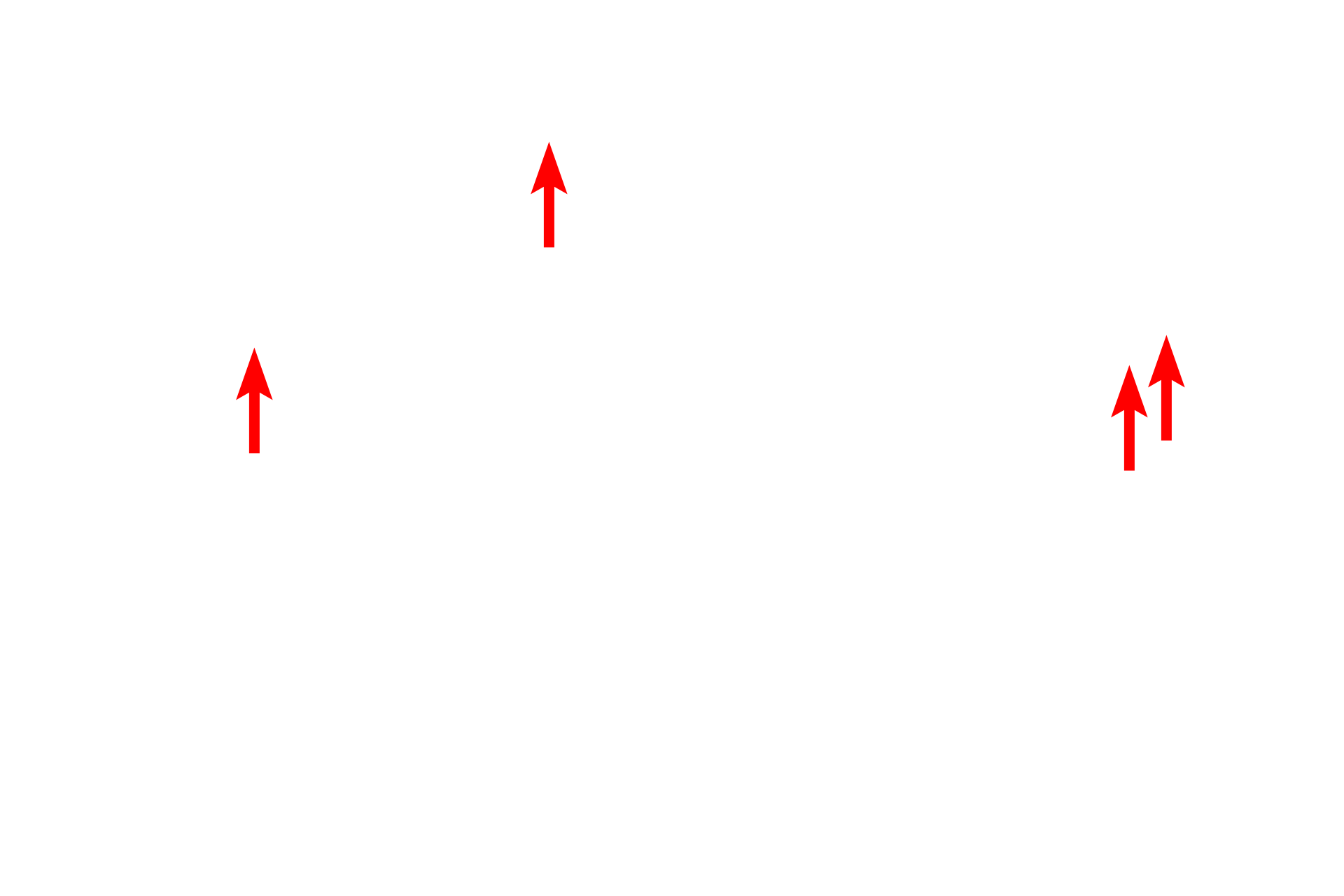 Glycogen granules <p>Nearly all cells contain some amount of glycogen; however, glycogen accumulations are commonly seen in very active cells, such as this cardiac muscle cell.  In this electron micrograph, glycogen is present between the bundles of contractile filaments which fill the cytoplasm.  15,000x</p>
