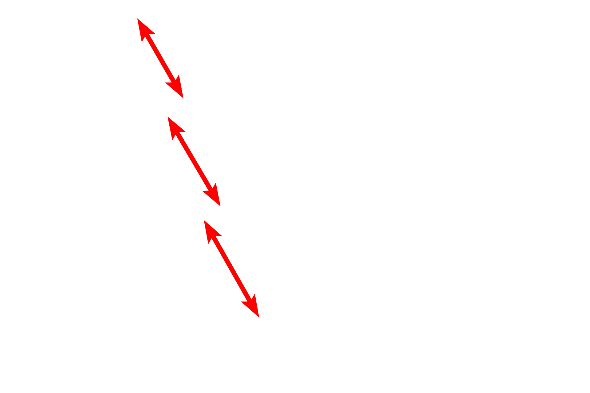 Bundles of contractile proteins (myofibrils) <p>Nearly all cells contain some amount of glycogen; however, glycogen accumulations are commonly seen in very active cells, such as this cardiac muscle cell.  In this electron micrograph, glycogen is present between the bundles of contractile filaments which fill the cytoplasm.  15,000x</p>
