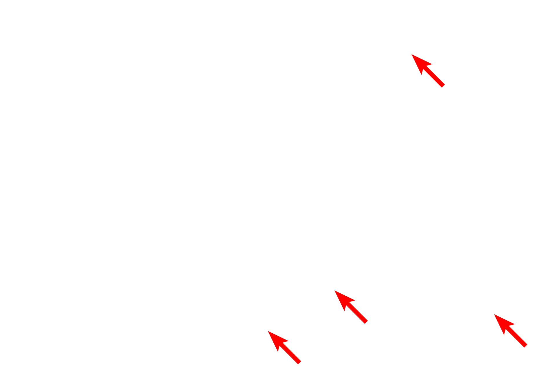 Mitochondria <p>Nearly all cells contain some amount of glycogen; however, glycogen accumulations are commonly seen in very active cells, such as this cardiac muscle cell.  In this electron micrograph, glycogen is present between the bundles of contractile filaments which fill the cytoplasm.  15,000x</p>
