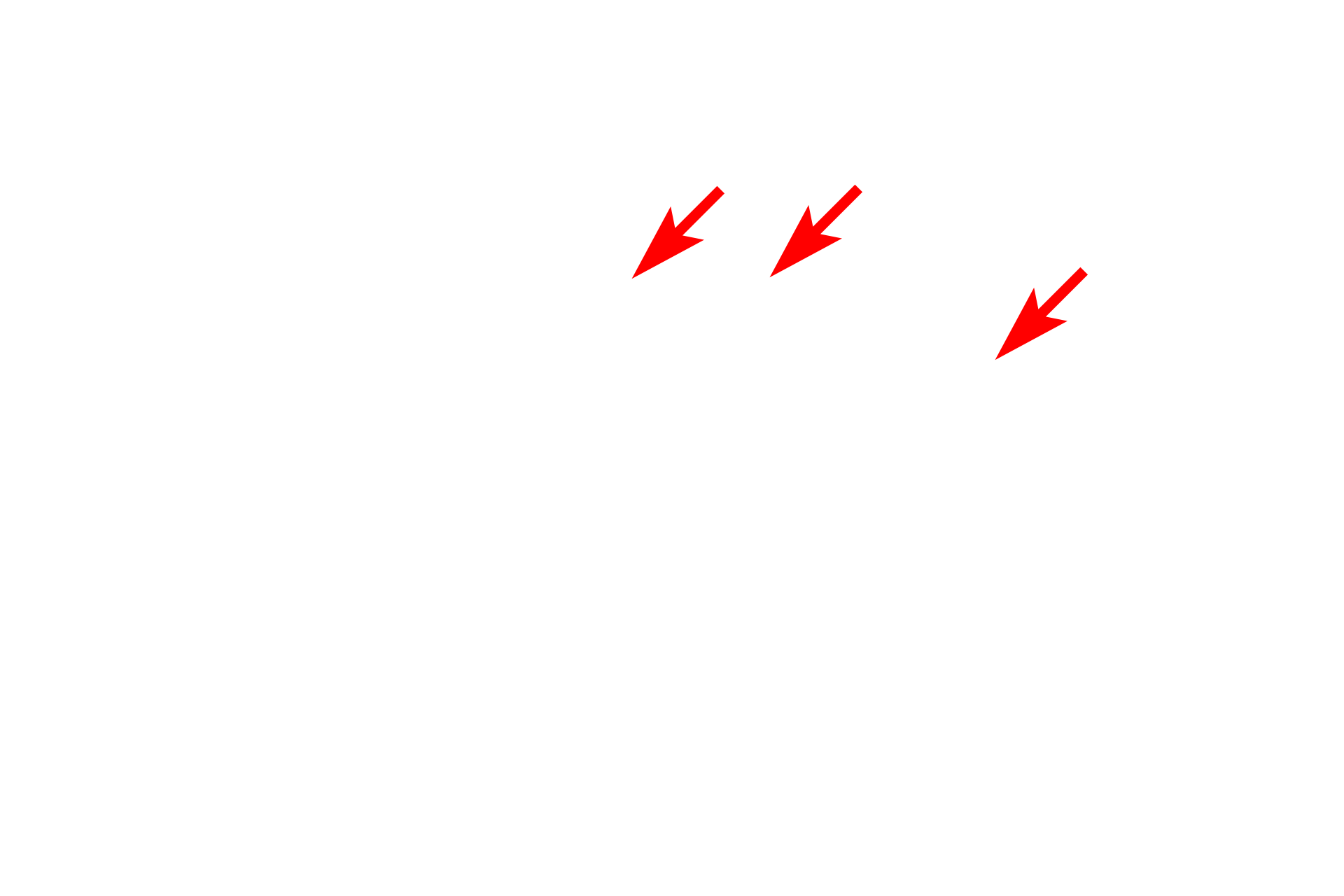 Transport vesicles <p>The Golgi, usually located near the nucleus, consists of flattened, membranous sacs. These sacs receive newly synthesized proteins from the RER via transport vesicles.  The vesicles fuse with the forming face of the Golgi, and their proteins are post-translationally modified, e.g., glycosylated or phosphorylated, and packaged on the maturing face of the Golgi for transport through the cell.</p>
