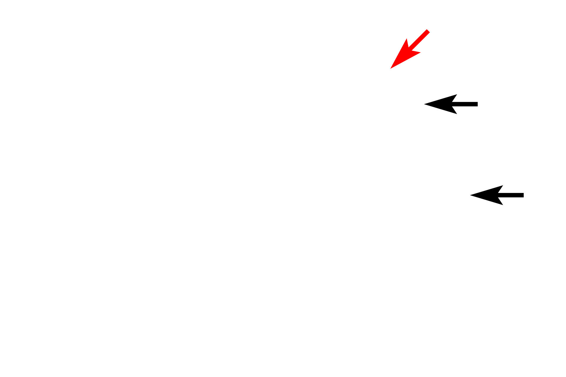 Secretory granules > <p>Secretory granules (black arrows), also referred to as secretory vesicles, are one of several types of vesicles derived from the Golgi.  Secretory granules contain proteins synthesized in the RER, that are secreted from the cells by exocytosis (red arrow). Examples of proteins transported by secretory granules include digestive enzymes, peptide hormones, and extracellular matrix components.</p>
