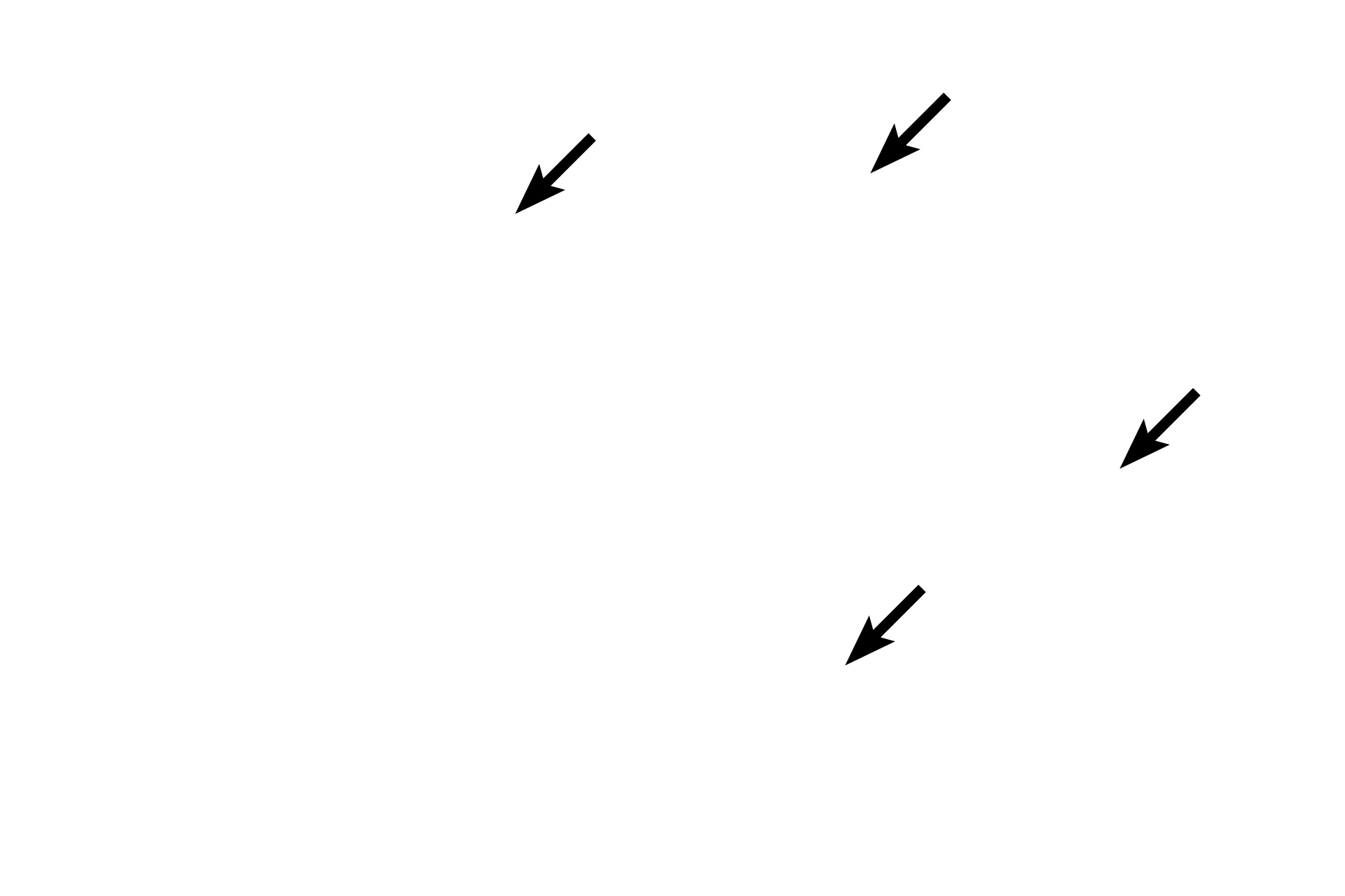 Golgi apparatus <p>The location of the Golgi is clearly evident in this H&E stained section of the pituitary gland.  The location of the Golgi apparatus appears as a pale-staining region of the cytoplasm adjacent to the nucleus, surrounded by the secretory granules it produces.  The large Golgi displaces the granules thus resulting is a lightly stained region, referred to as “negative Golgi” image.   The structure of the Golgi apparatus cannot be seen with H&E staining.  1000x</p>
