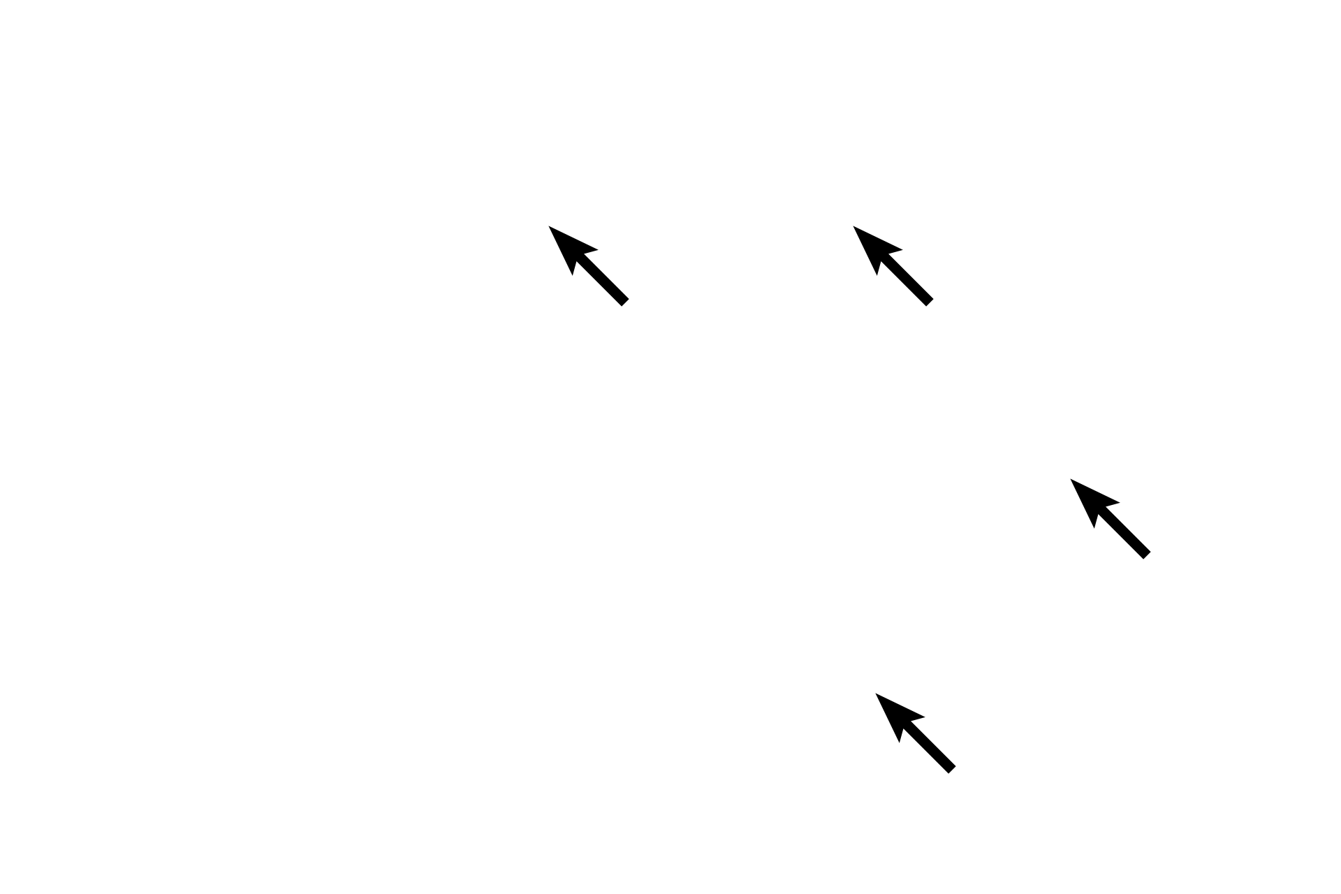 Secretory granules <p>The location of the Golgi is clearly evident in this H&E stained section of the pituitary gland.  The location of the Golgi apparatus appears as a pale-staining region of the cytoplasm adjacent to the nucleus, surrounded by the secretory granules it produces.  The large Golgi displaces the granules thus resulting is a lightly stained region, referred to as “negative Golgi” image.   The structure of the Golgi apparatus cannot be seen with H&E staining.  1000x</p>
