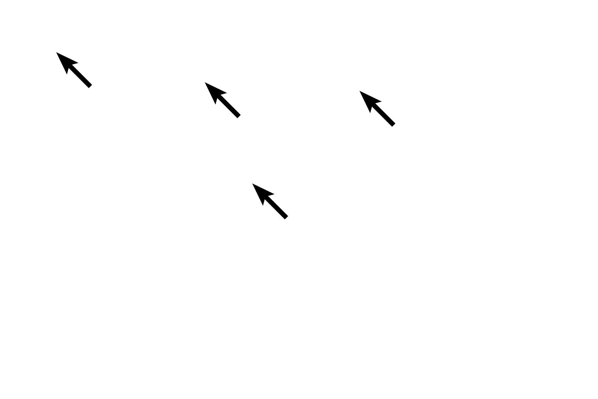  - Nucleoli <p>The location of the Golgi is clearly evident in this H&E stained section of the pituitary gland.  The location of the Golgi apparatus appears as a pale-staining region of the cytoplasm adjacent to the nucleus, surrounded by the secretory granules it produces.  The large Golgi displaces the granules thus resulting is a lightly stained region, referred to as “negative Golgi” image.   The structure of the Golgi apparatus cannot be seen with H&E staining.  1000x</p>
