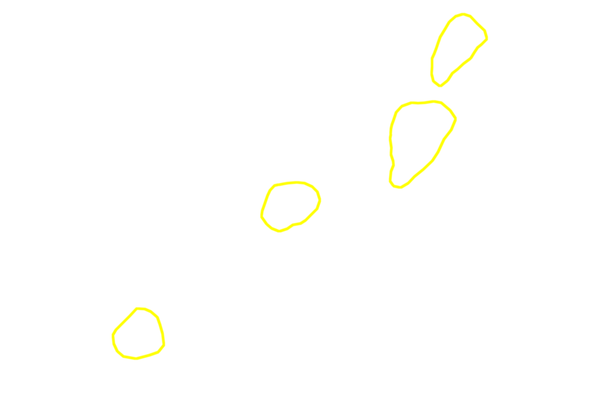 Plasma cells <p>With H&E preparations, the Golgi stains faintly pink and its location is indicated by a pale area adjacent to the nucleus in these plasma cells. This lightly stained region is referred to as a “negative GoIgi” that results from the displacement of the abundant, basophilically-stained RER around it.  Plasma cells produce antibodies.  1000x</p>
