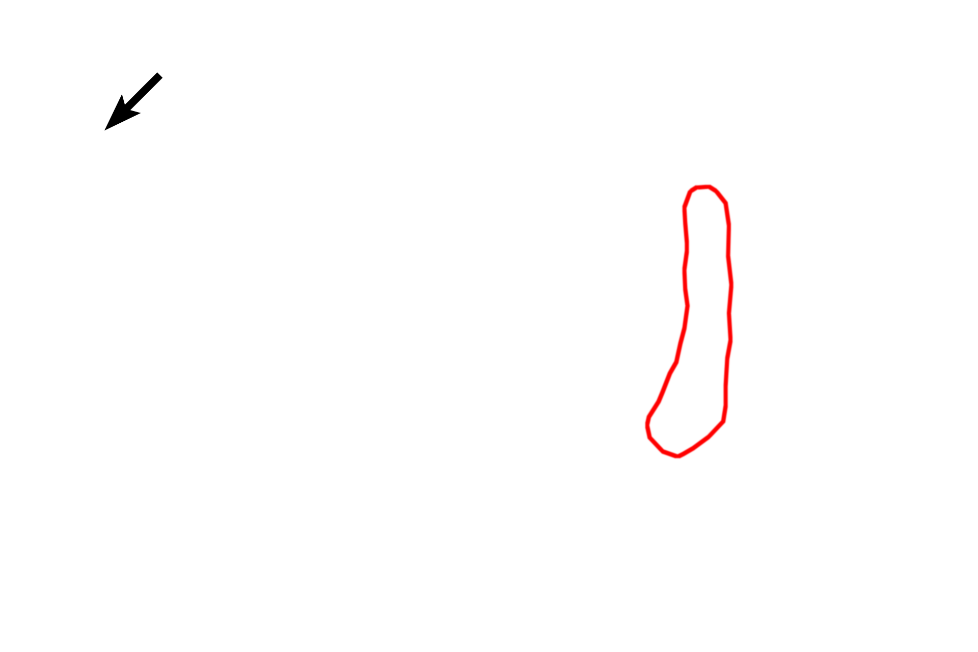 Golgi apparatus <p>This electron micrograph shows a plasma cell with a very large Golgi apparatus. The light microscopic appearance of a similar cell is shown in the inset. This large Golgi lies adjacent to the nucleus and is surrounded by extensive RER.  10,000x</p>
