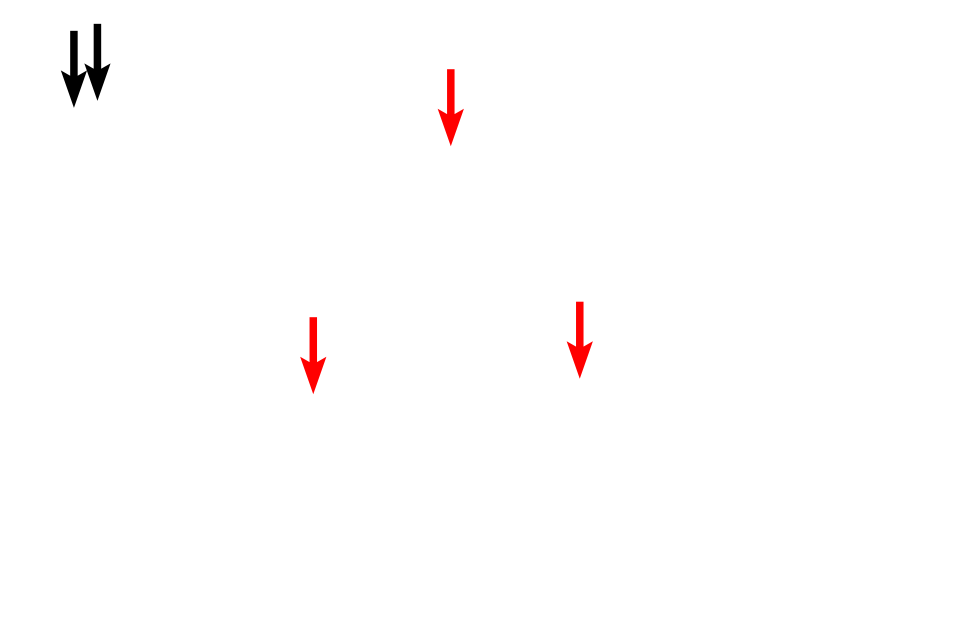 Heterochromatin <p>This electron micrograph shows a plasma cell with a very large Golgi apparatus. The light microscopic appearance of a similar cell is shown in the inset. This large Golgi lies adjacent to the nucleus and is surrounded by extensive RER.  10,000x</p>
